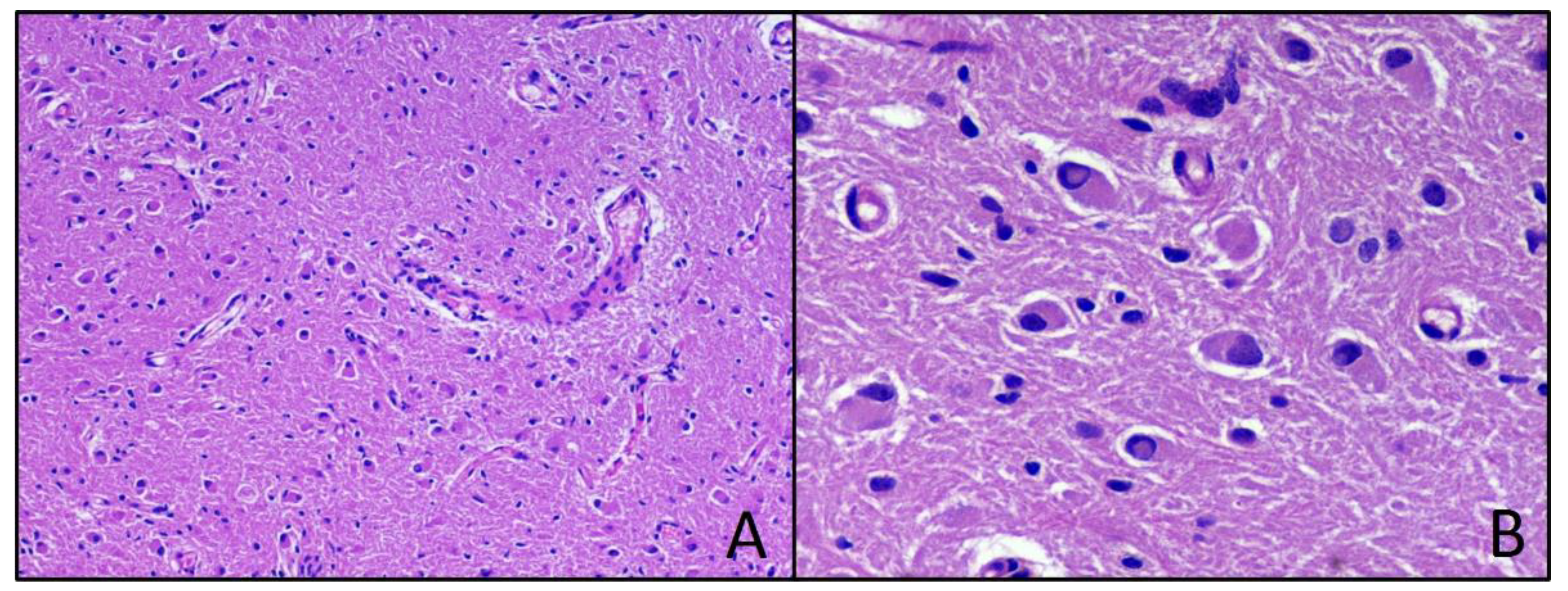 Neurolint 13 00053 g003