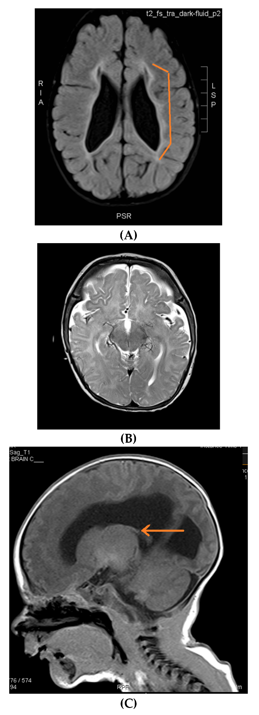 Neurolint 14 00021 g002a