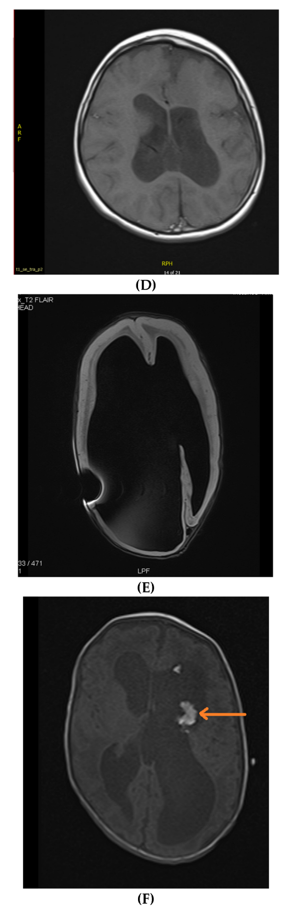 Neurolint 14 00021 g002b