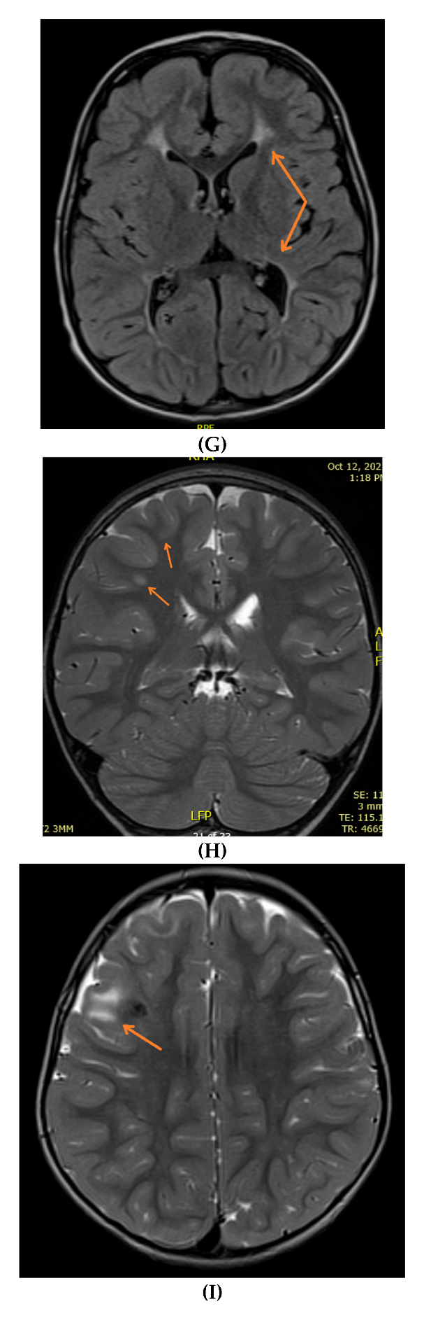 Neurolint 14 00021 g002c