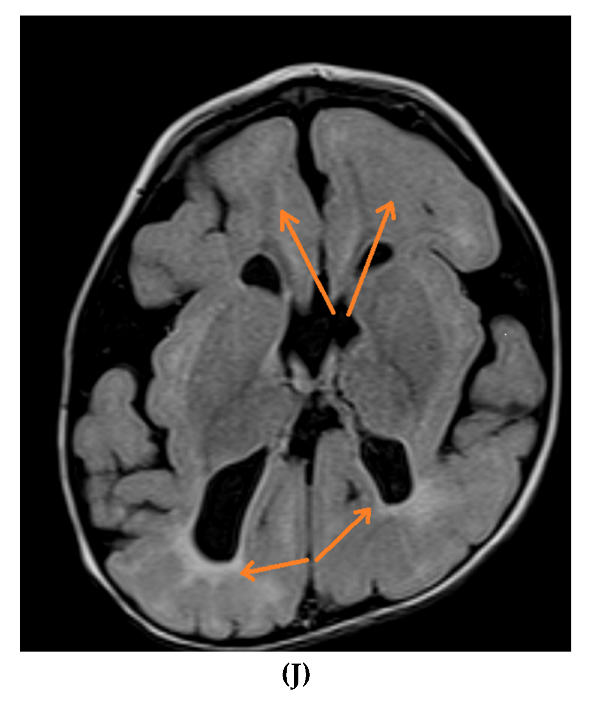 Neurolint 14 00021 g002d