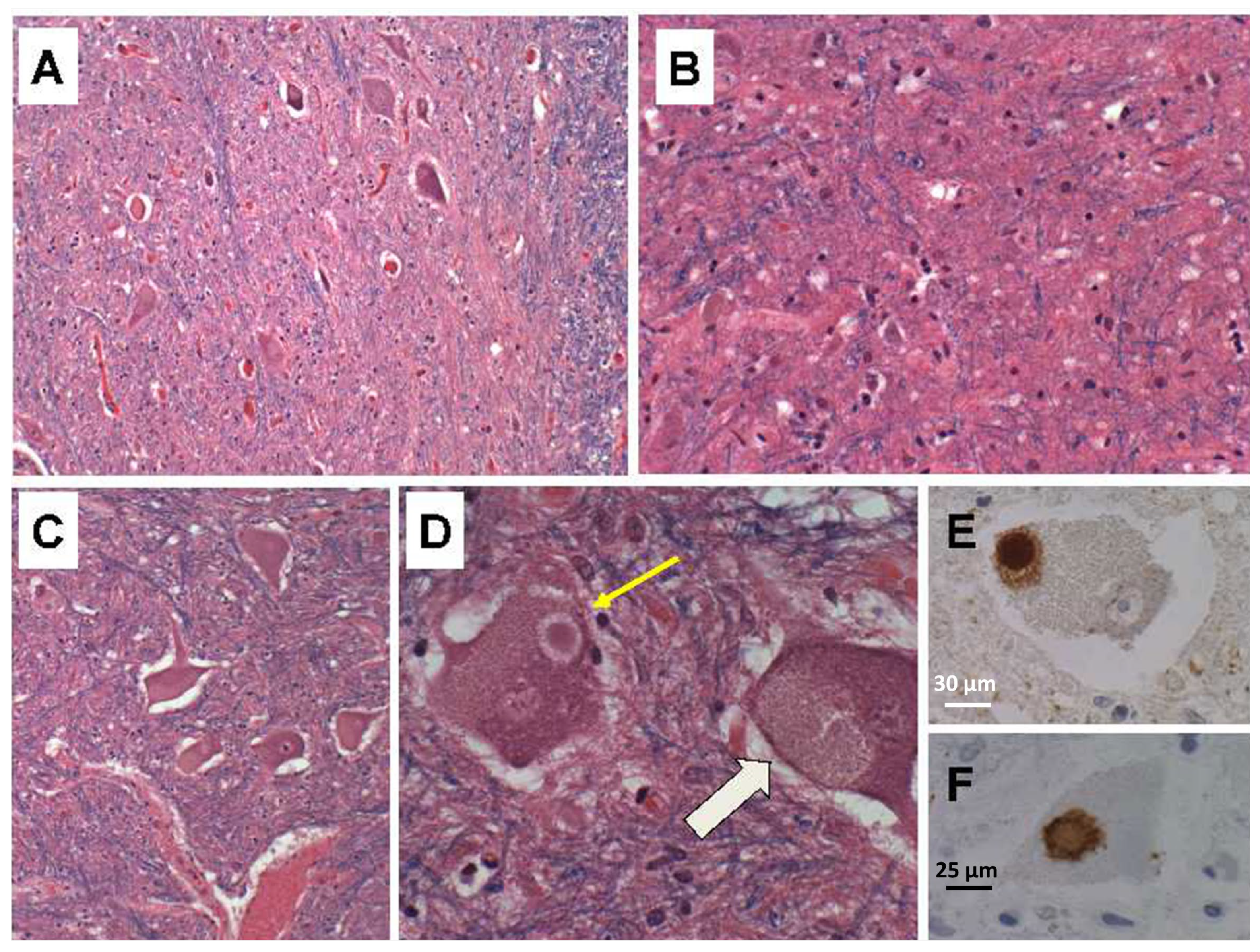 Neurolint 15 00035 g003