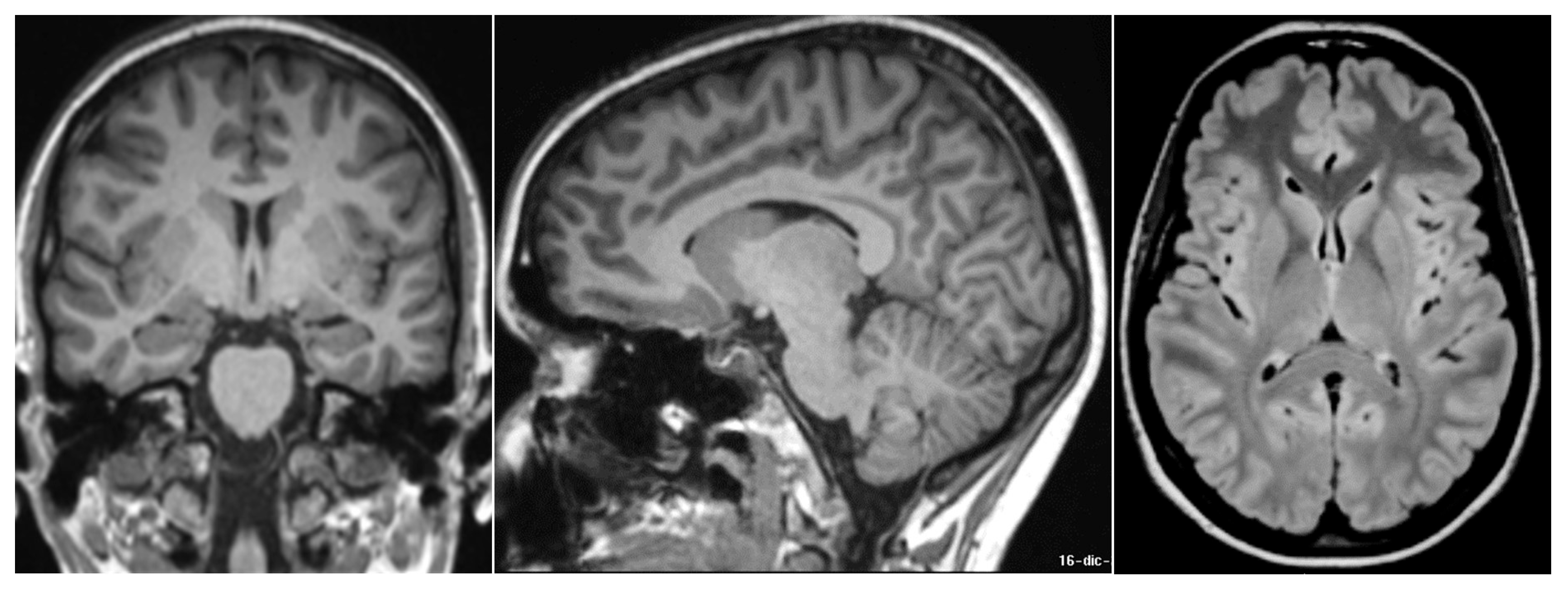 Neurolint 15 00058 g001