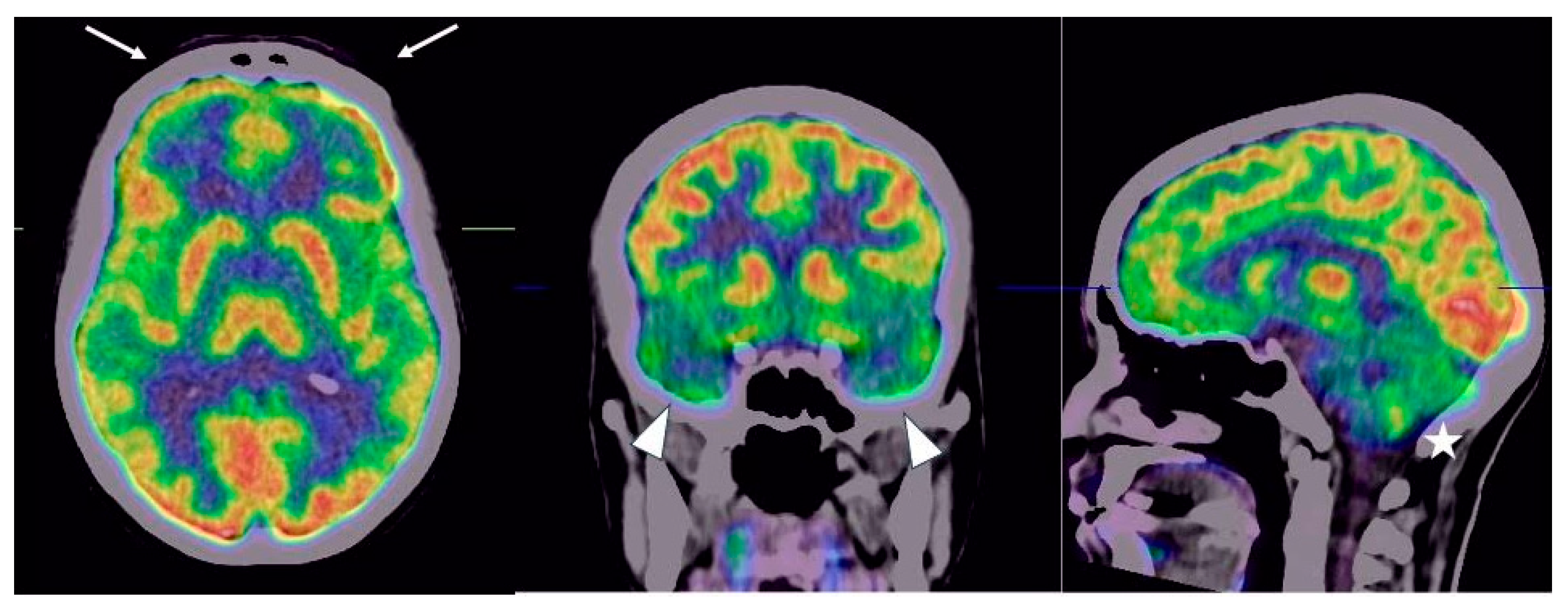 Neurolint 15 00058 g003