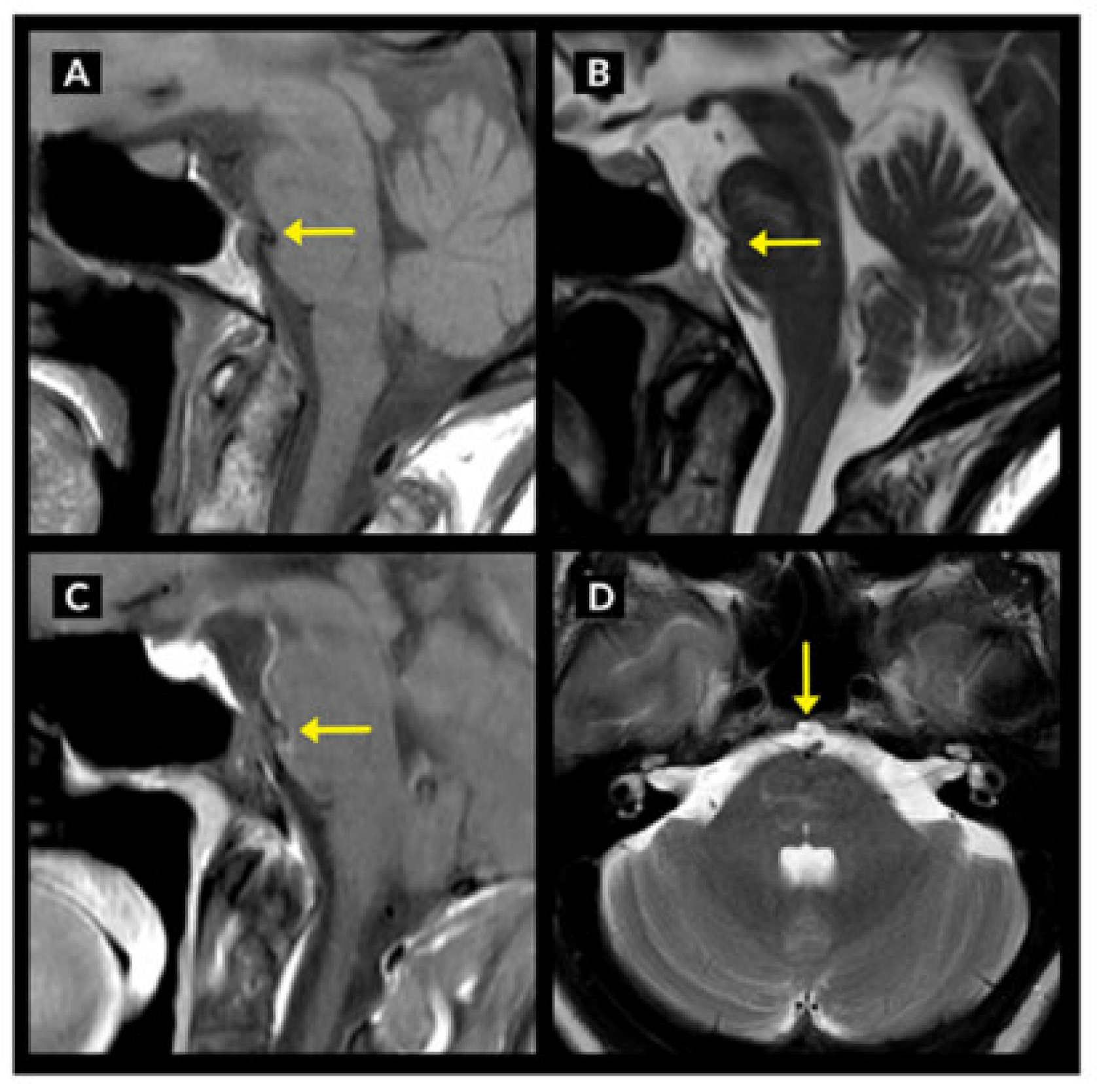 Neurolint 15 00075 g002 Neurolint 15 00075 g002