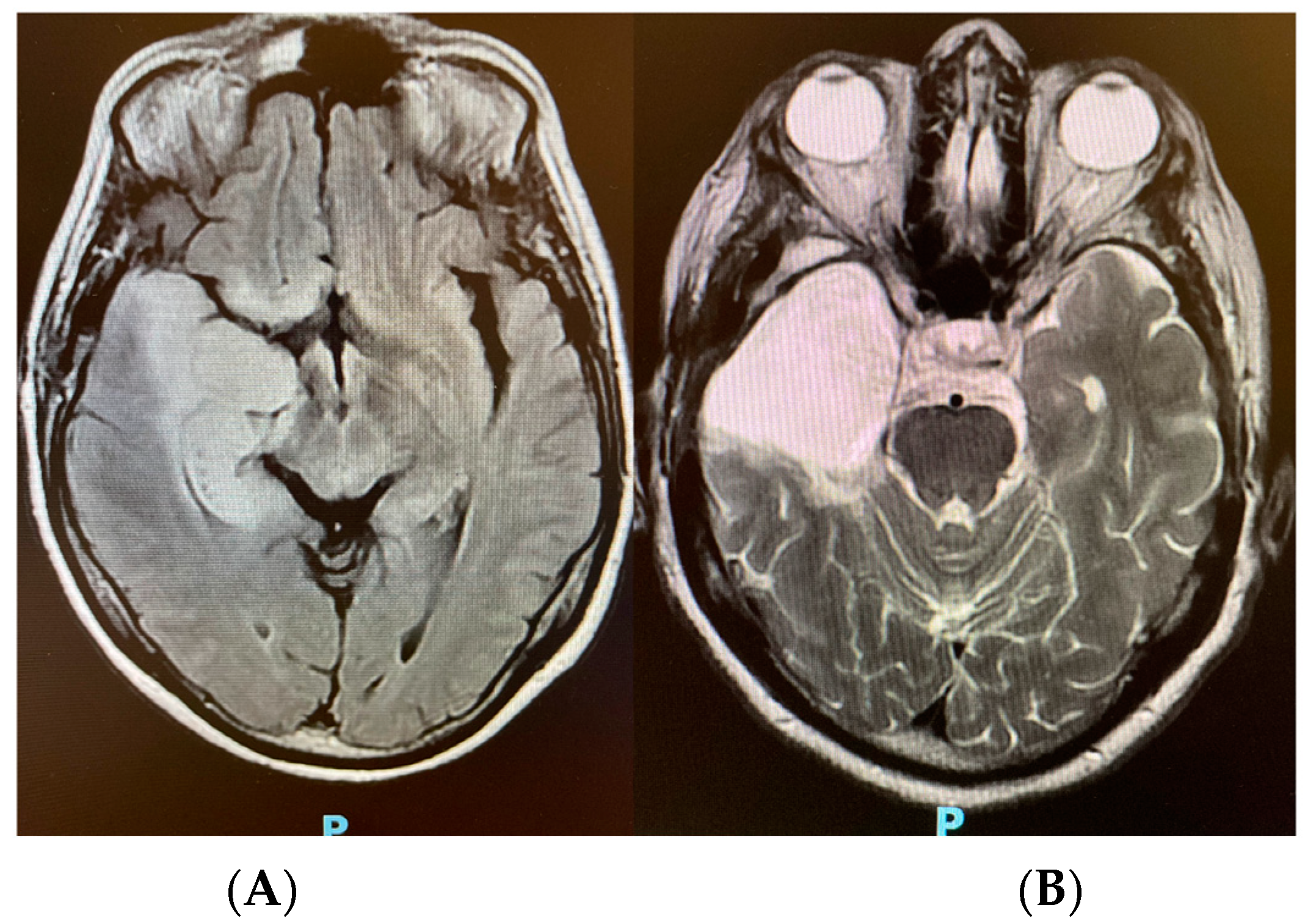 Neurolint 15 00090 g004