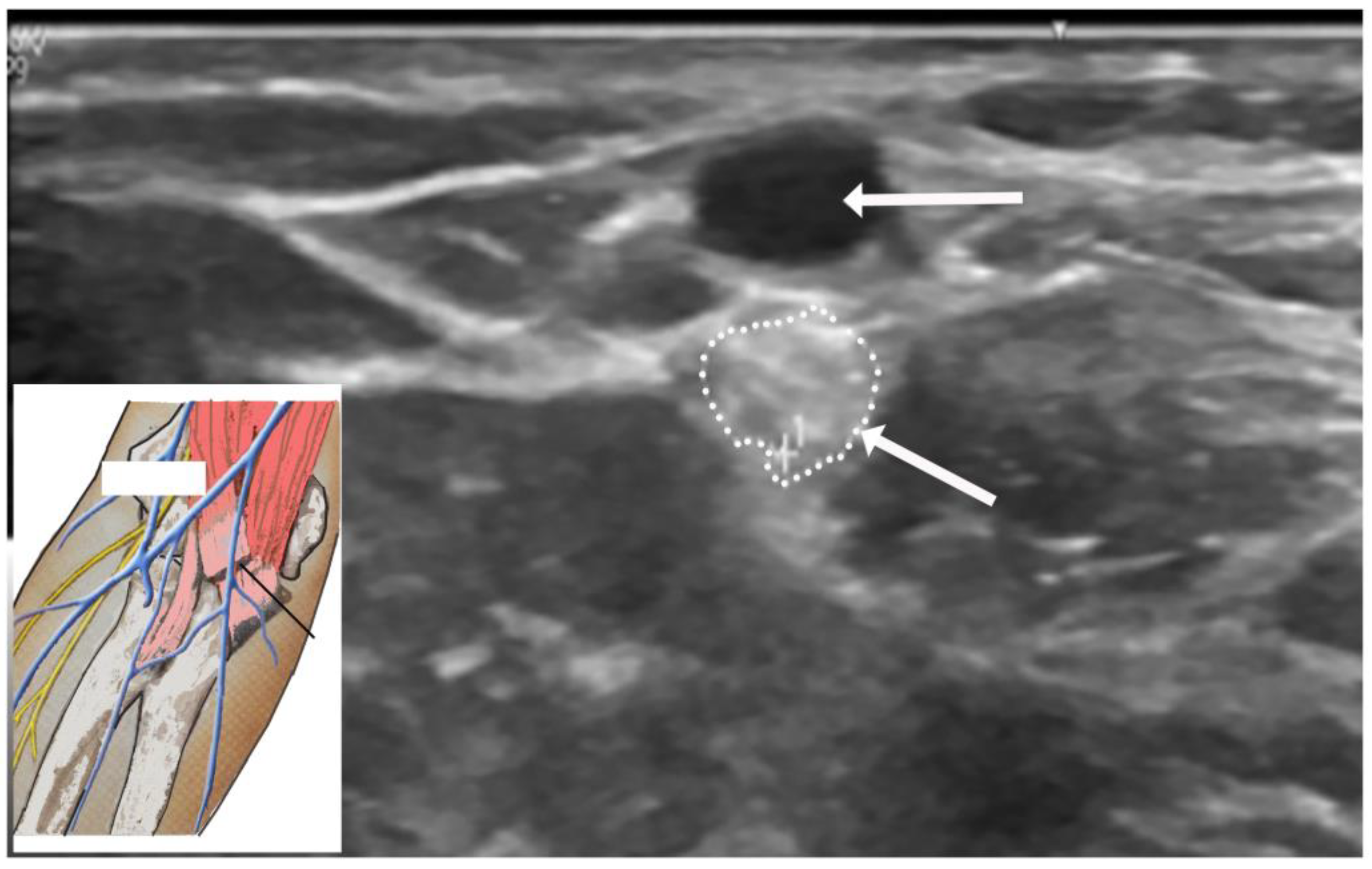Neurolint 16 00086 g005 Neurolint 16 00086 g005