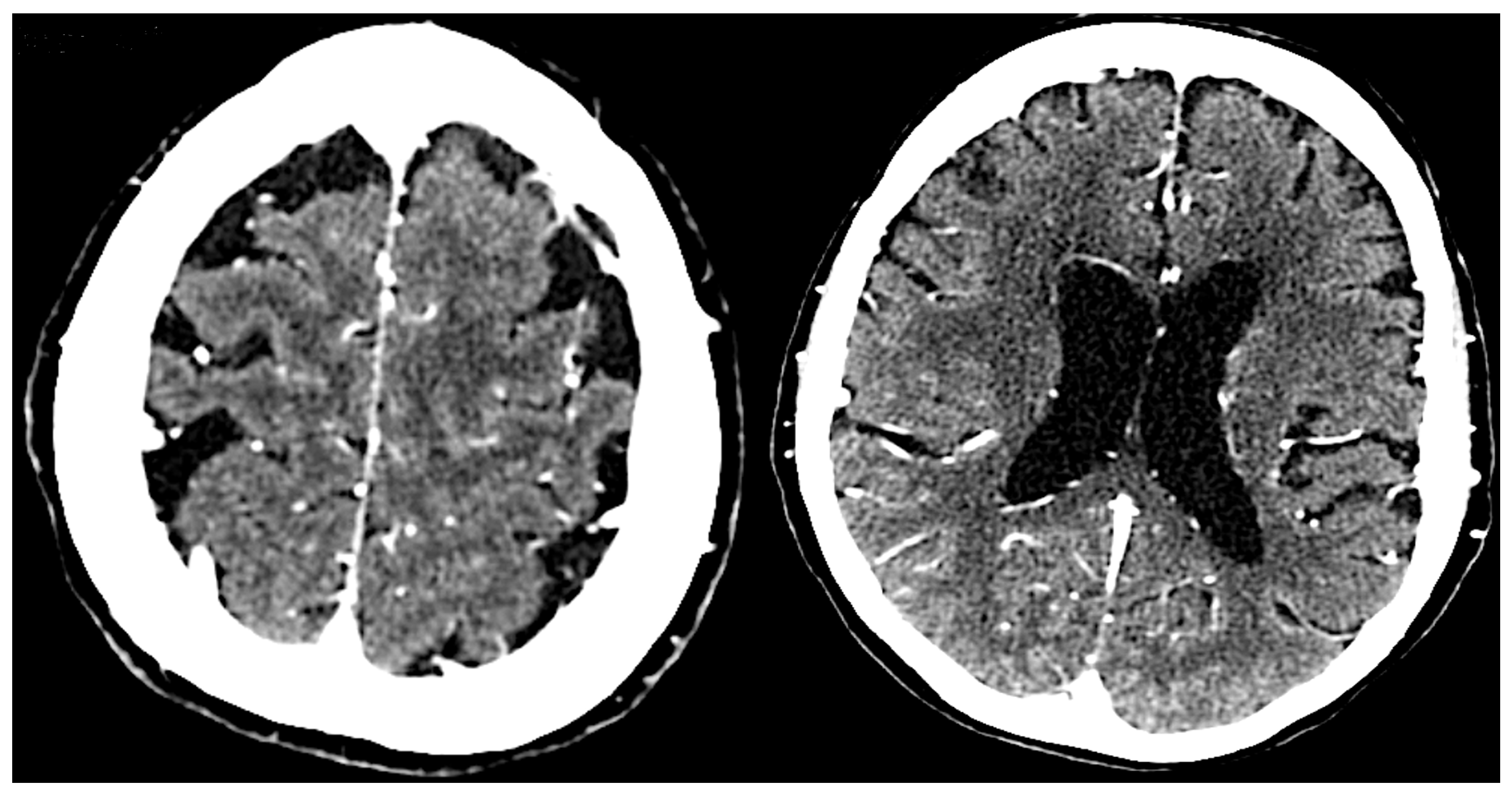 Neurolint 16 00120 g002