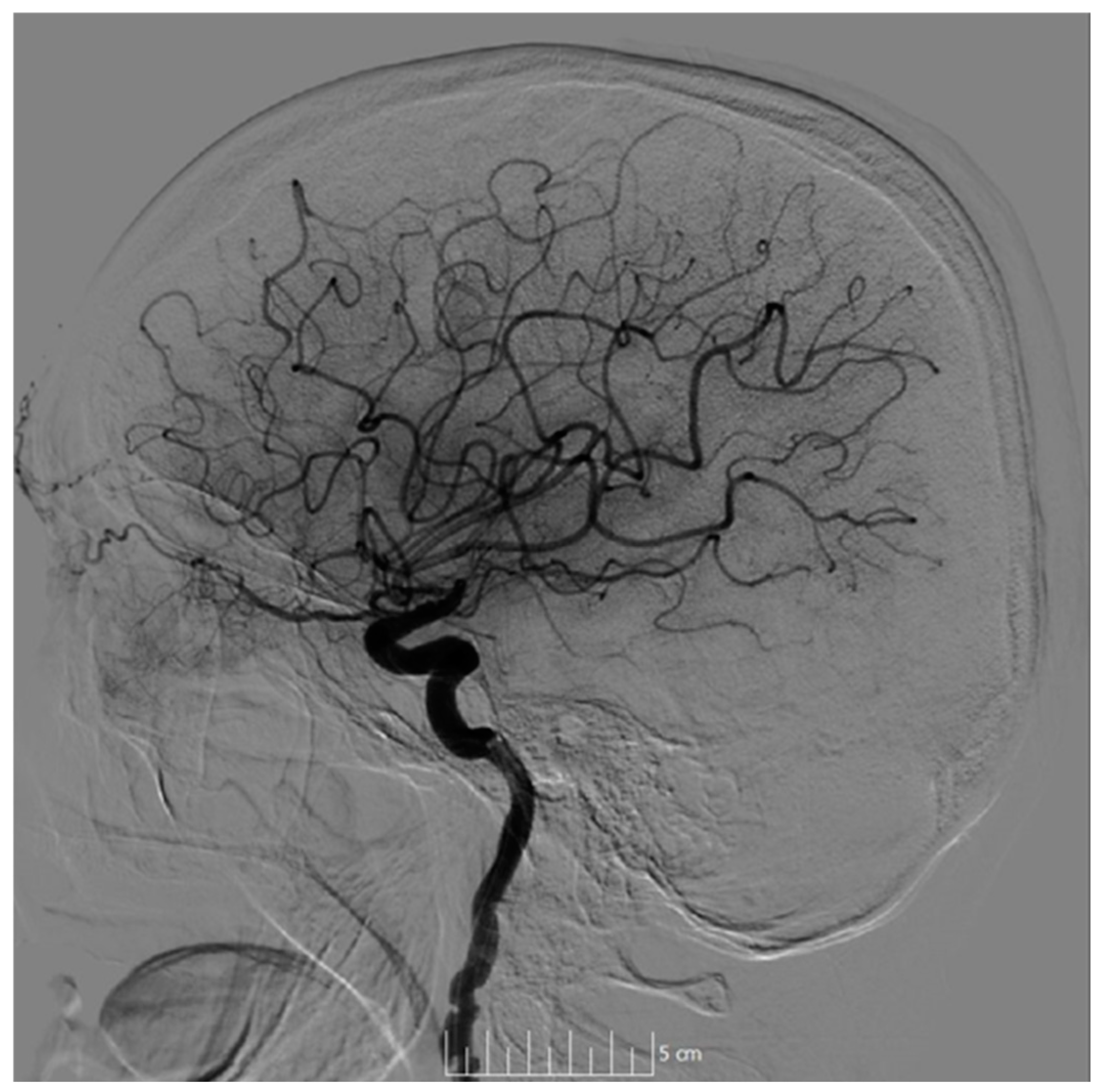 Neurolint 17 00003 g003