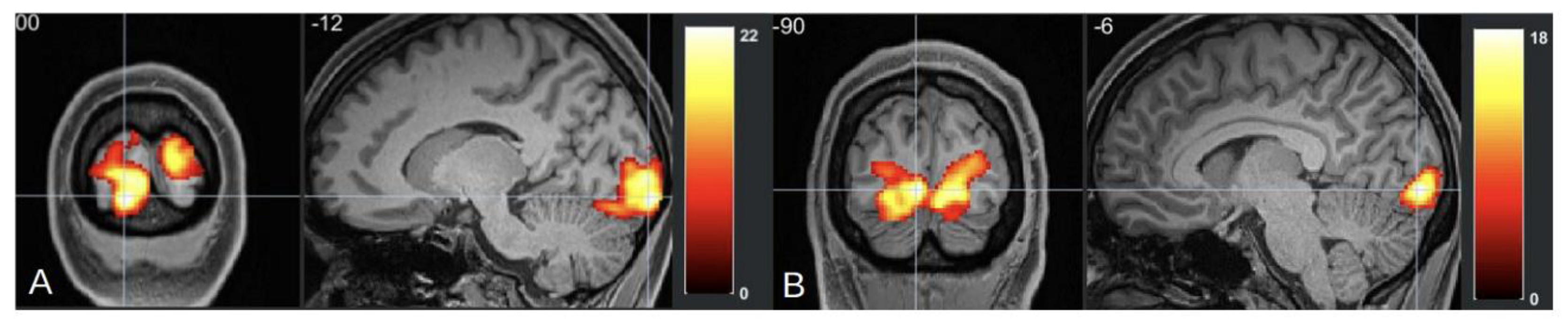 Neurolint 17 00015 g003
