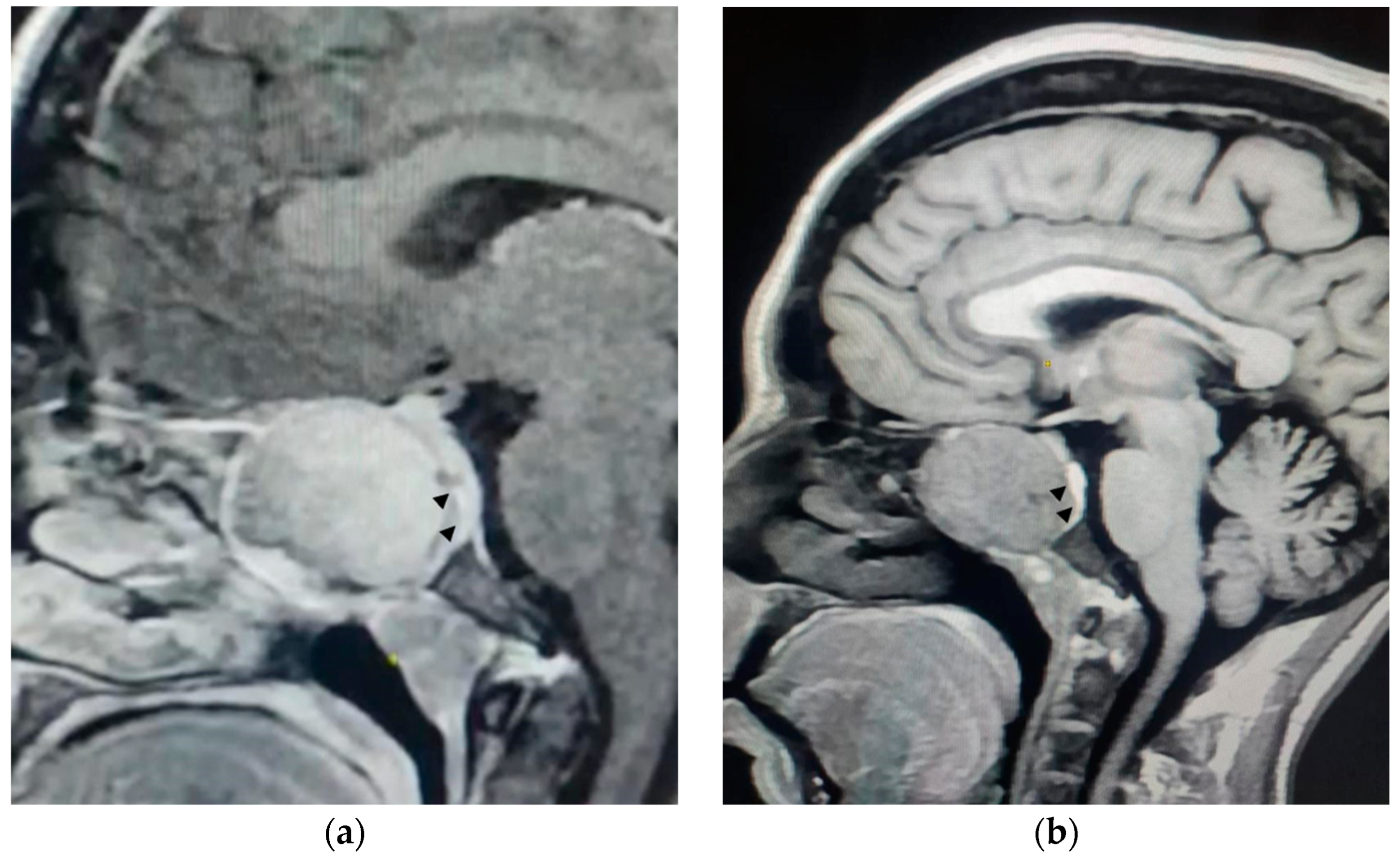 Neurolint 17 00022 g001