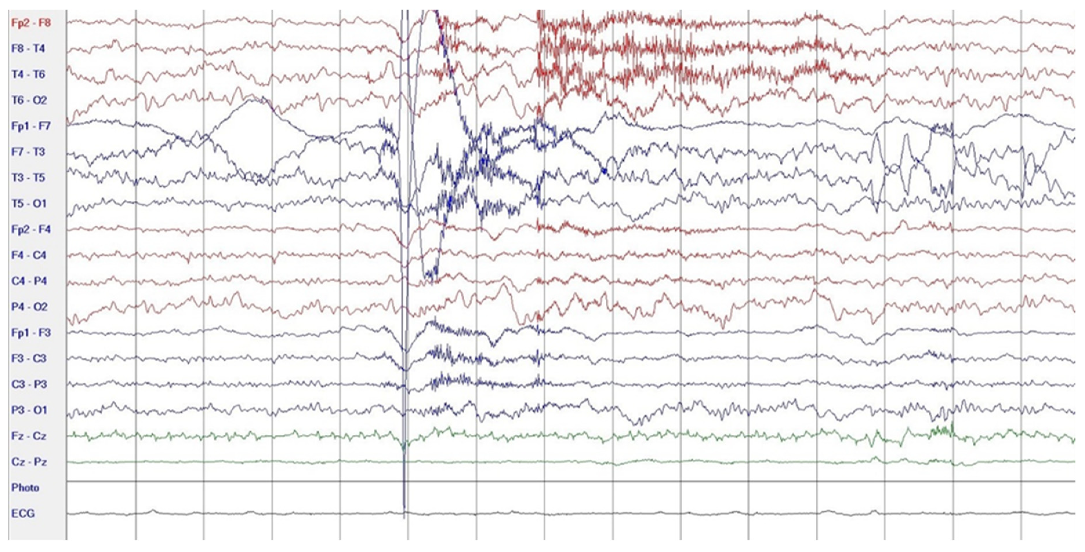 Neurolint 17 00037 g001