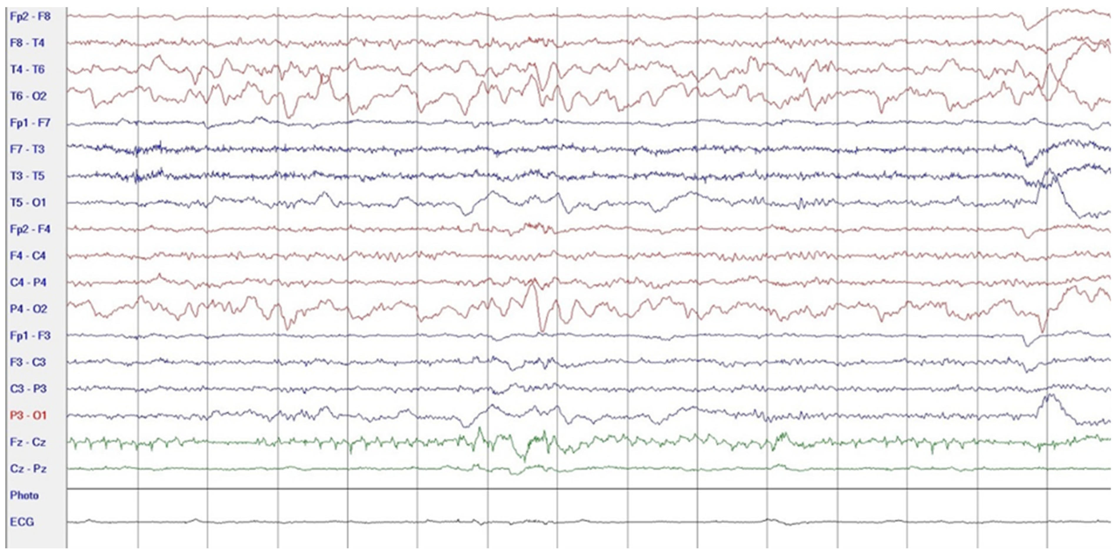 Neurolint 17 00037 g002