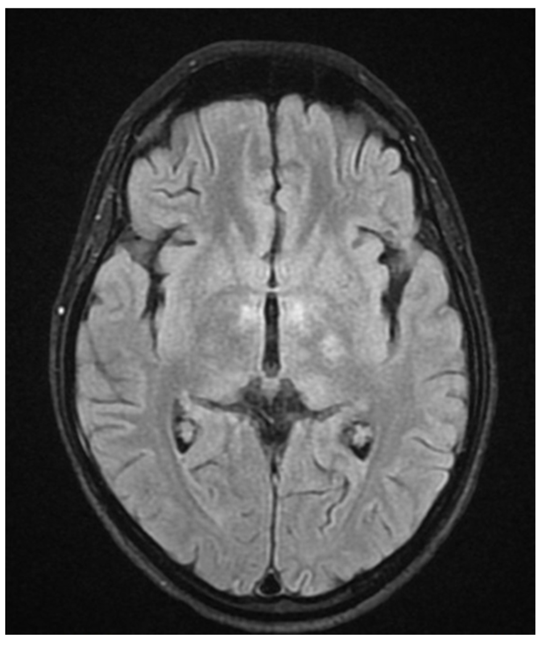 Neurolint 17 00037 g003