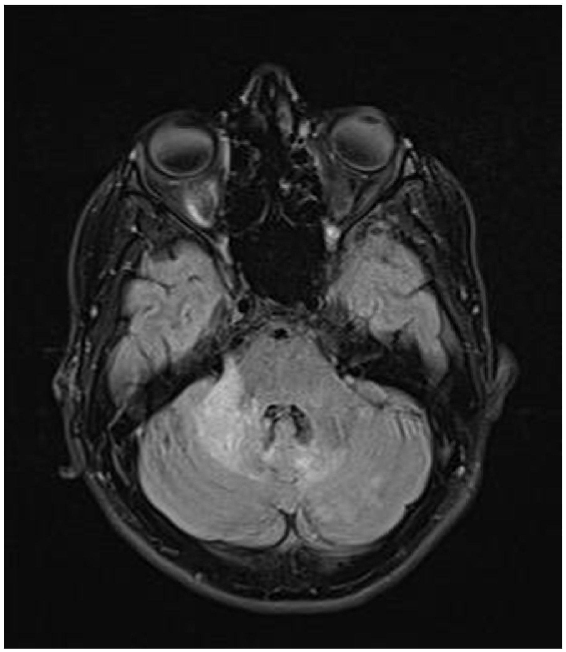 Neurolint 17 00037 g005
