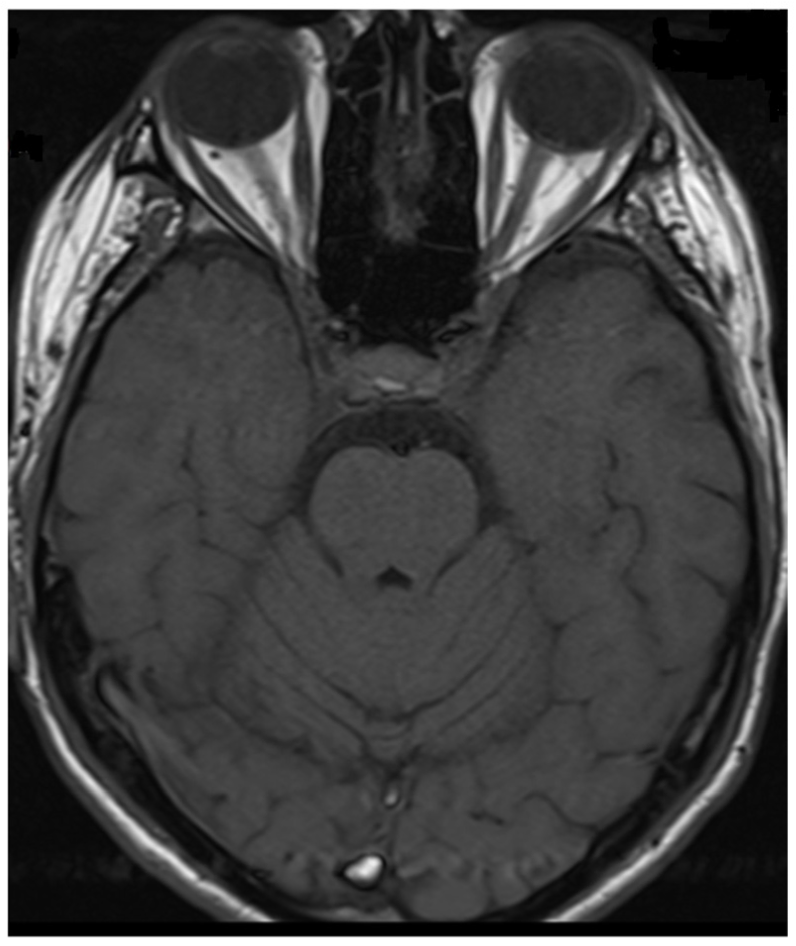 Neurolint 17 00037 g010