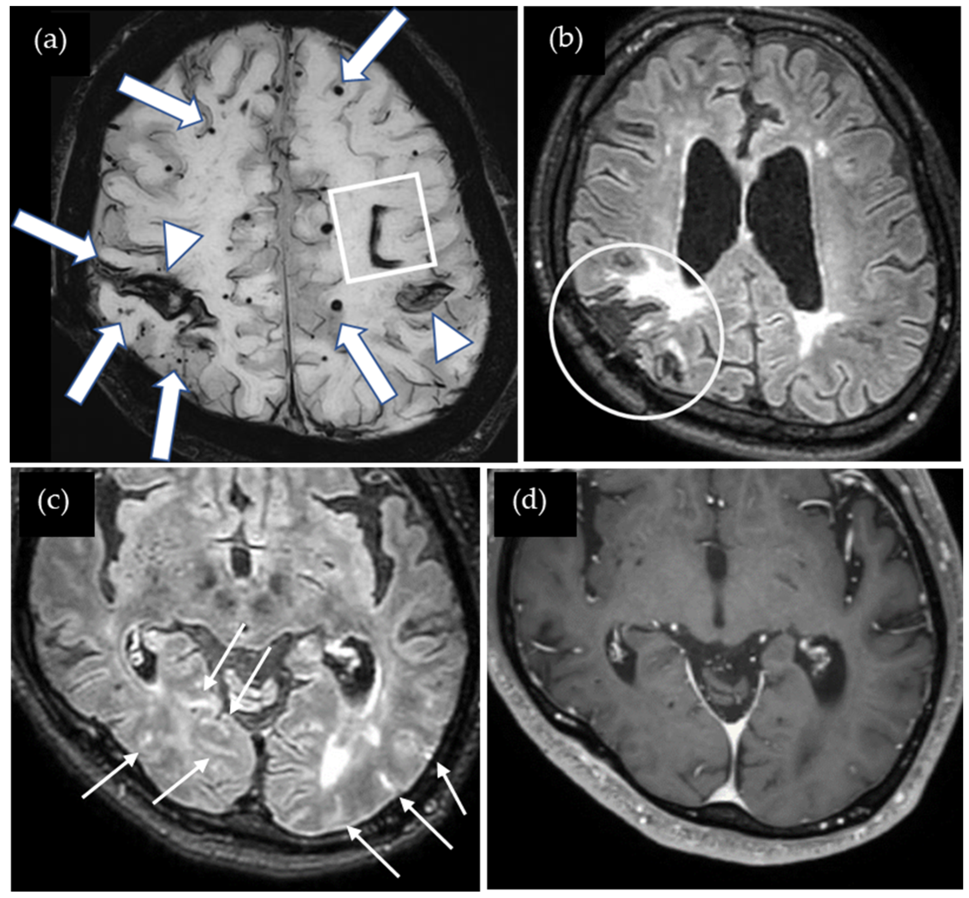 Neurolint 17 00064 g004