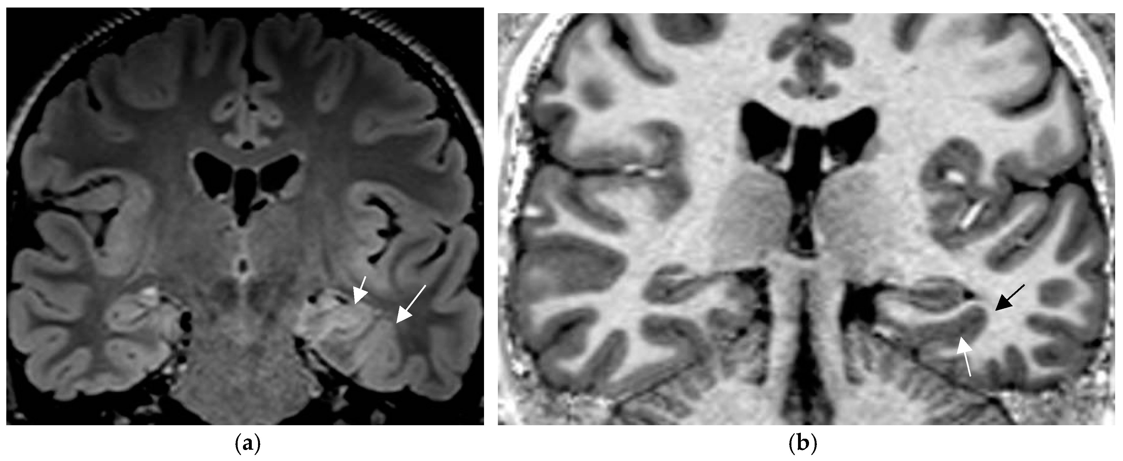 Neurolint 17 00066 g001