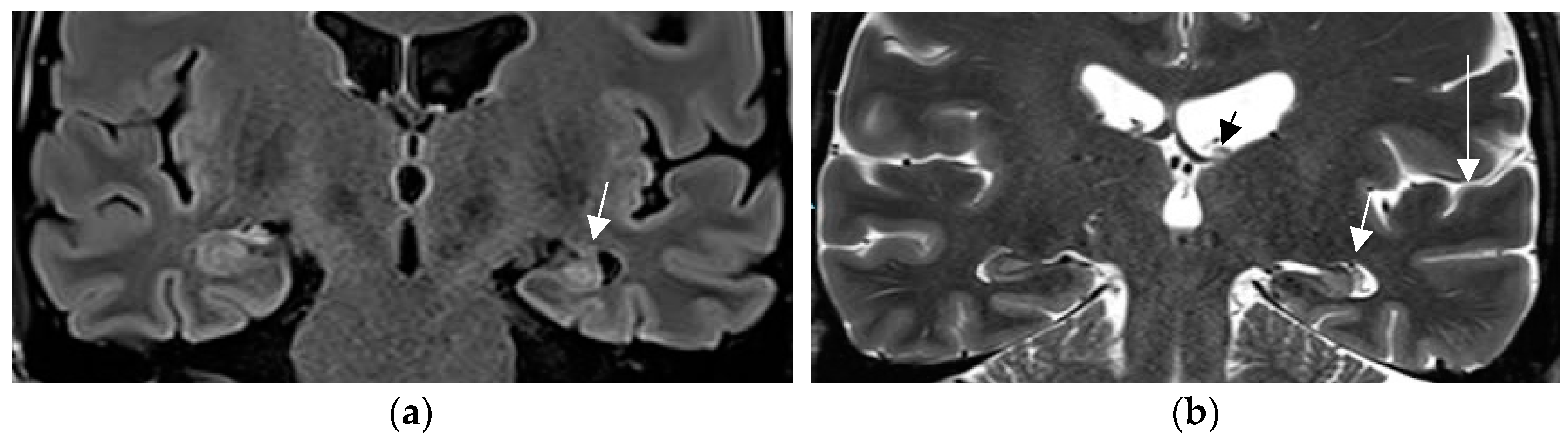 Neurolint 17 00066 g002