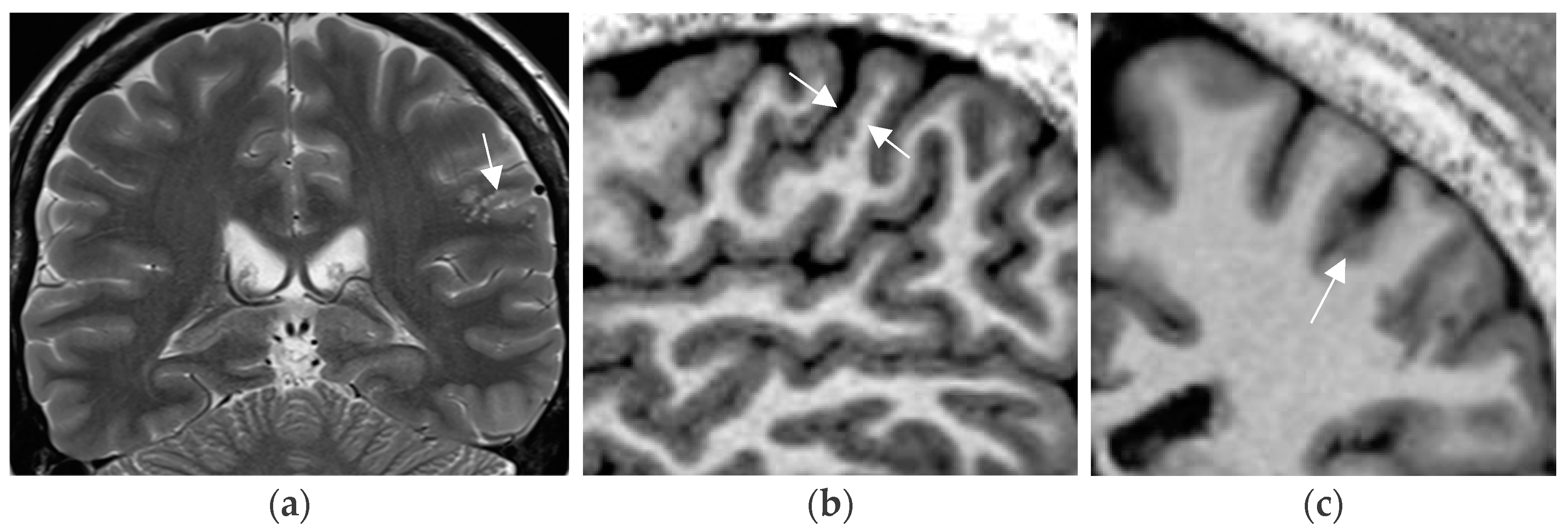 Neurolint 17 00066 g003