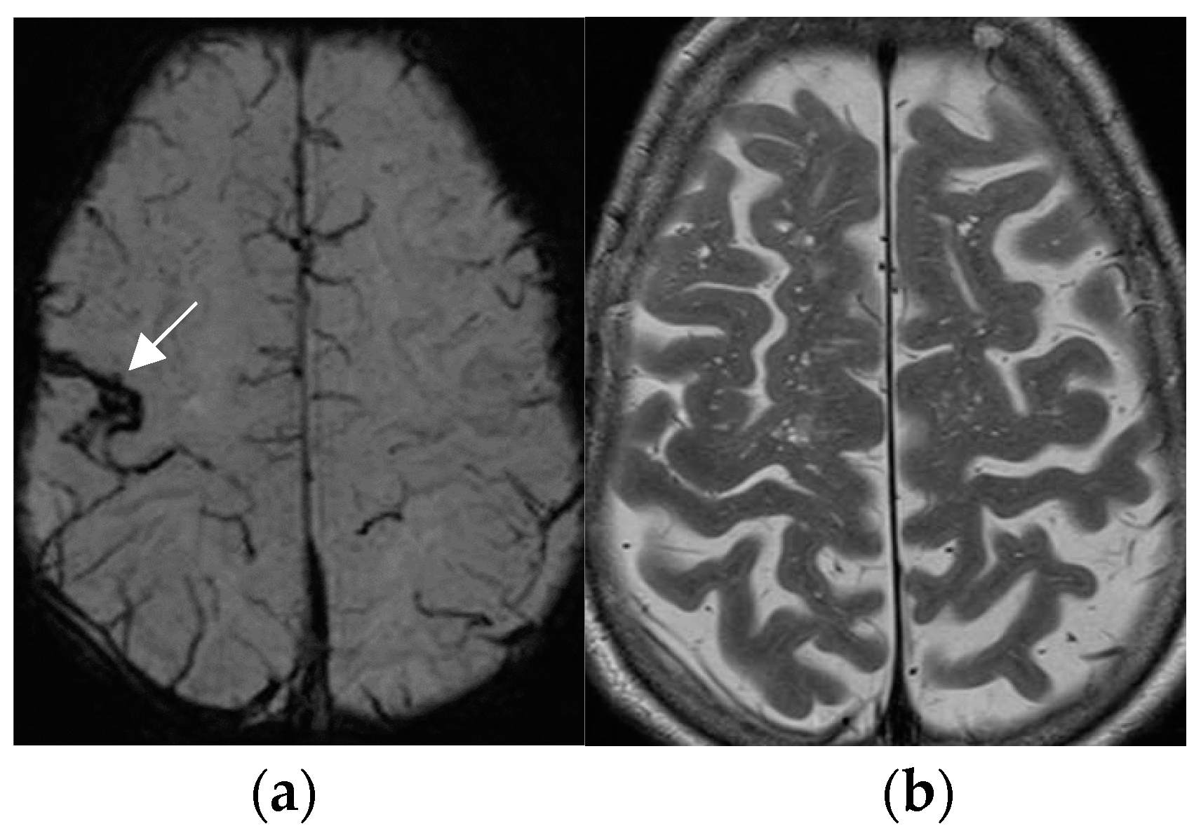 Neurolint 17 00066 g004