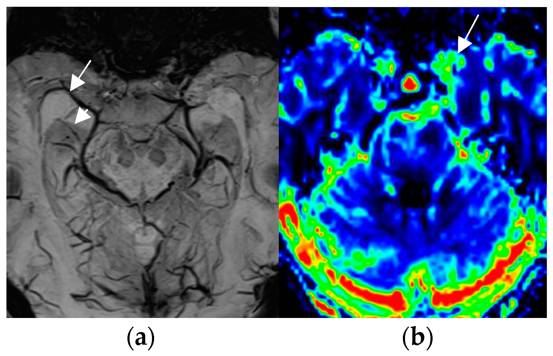 Neurolint 17 00066 g005