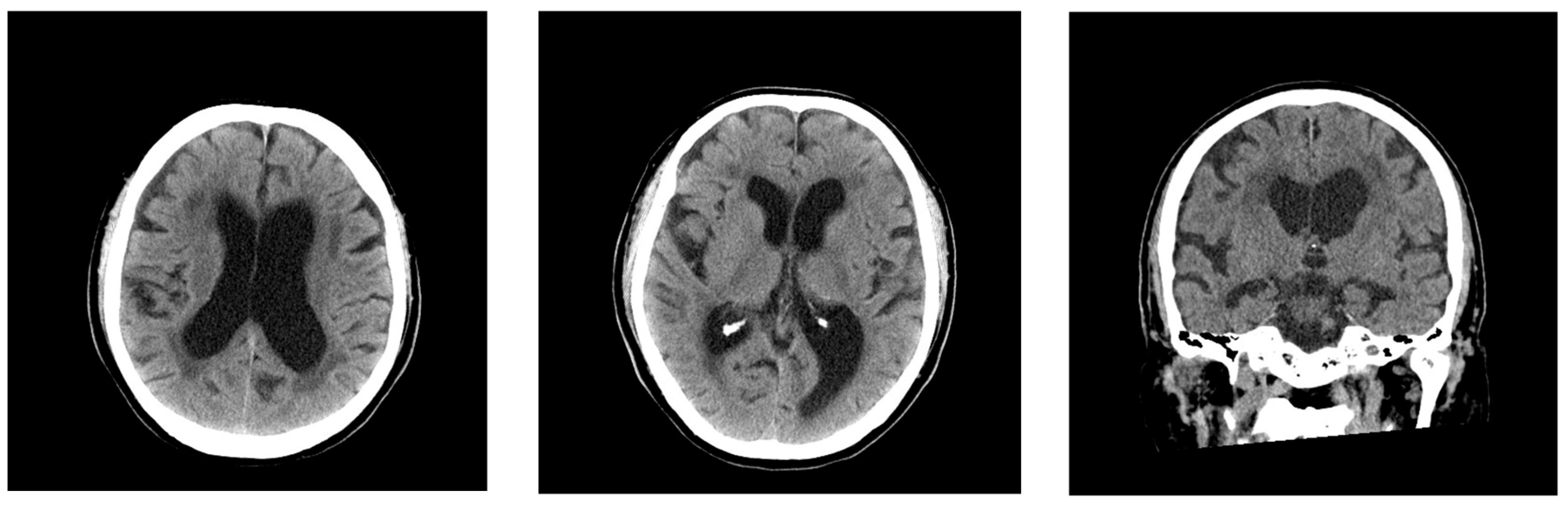 Neurolint 17 00086 g001