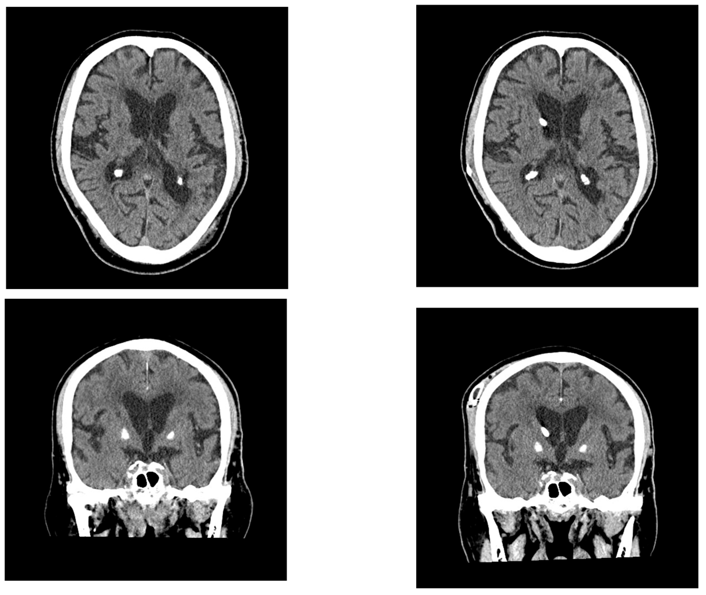 Neurolint 17 00086 g005