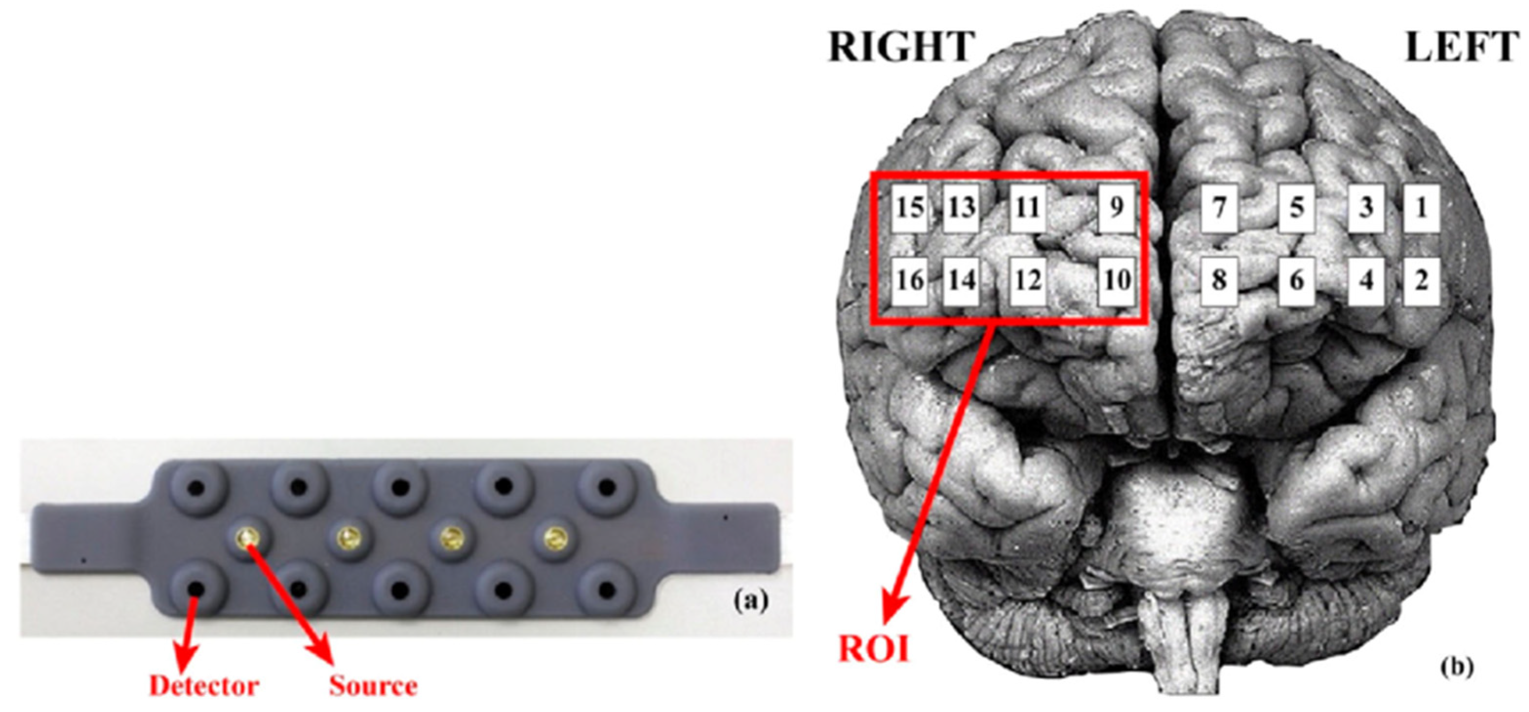 Neurolint 17 00108 g002
