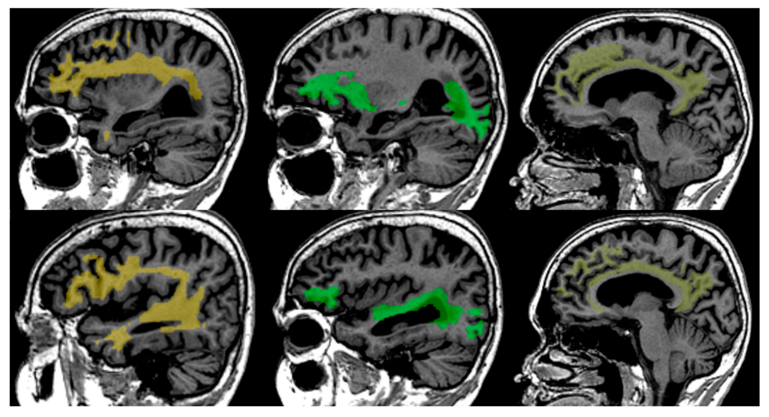 Neurolint 17 00154 g001