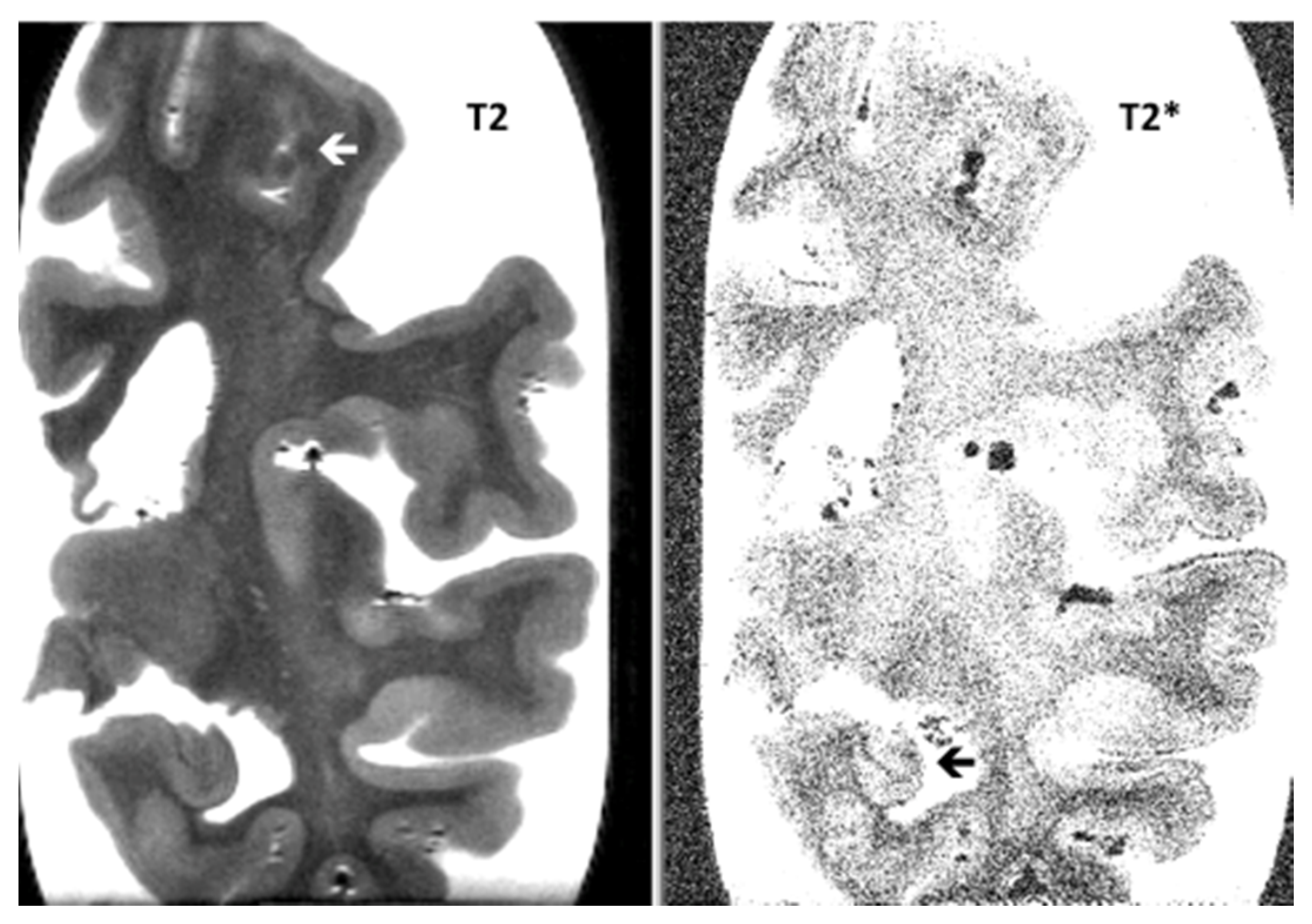 Neurosci 01 00011 g001