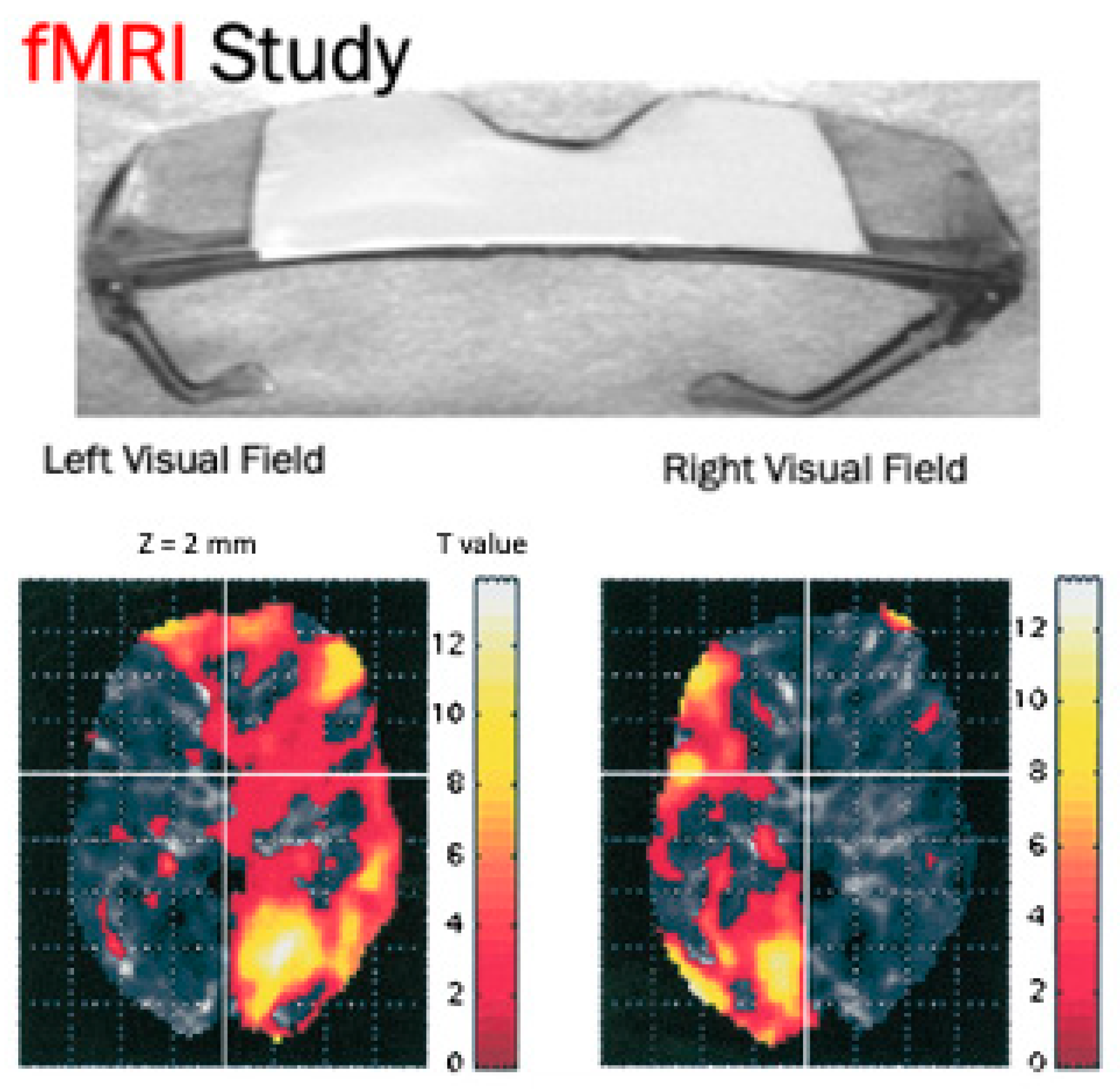 Neurosci 02 00016 g001