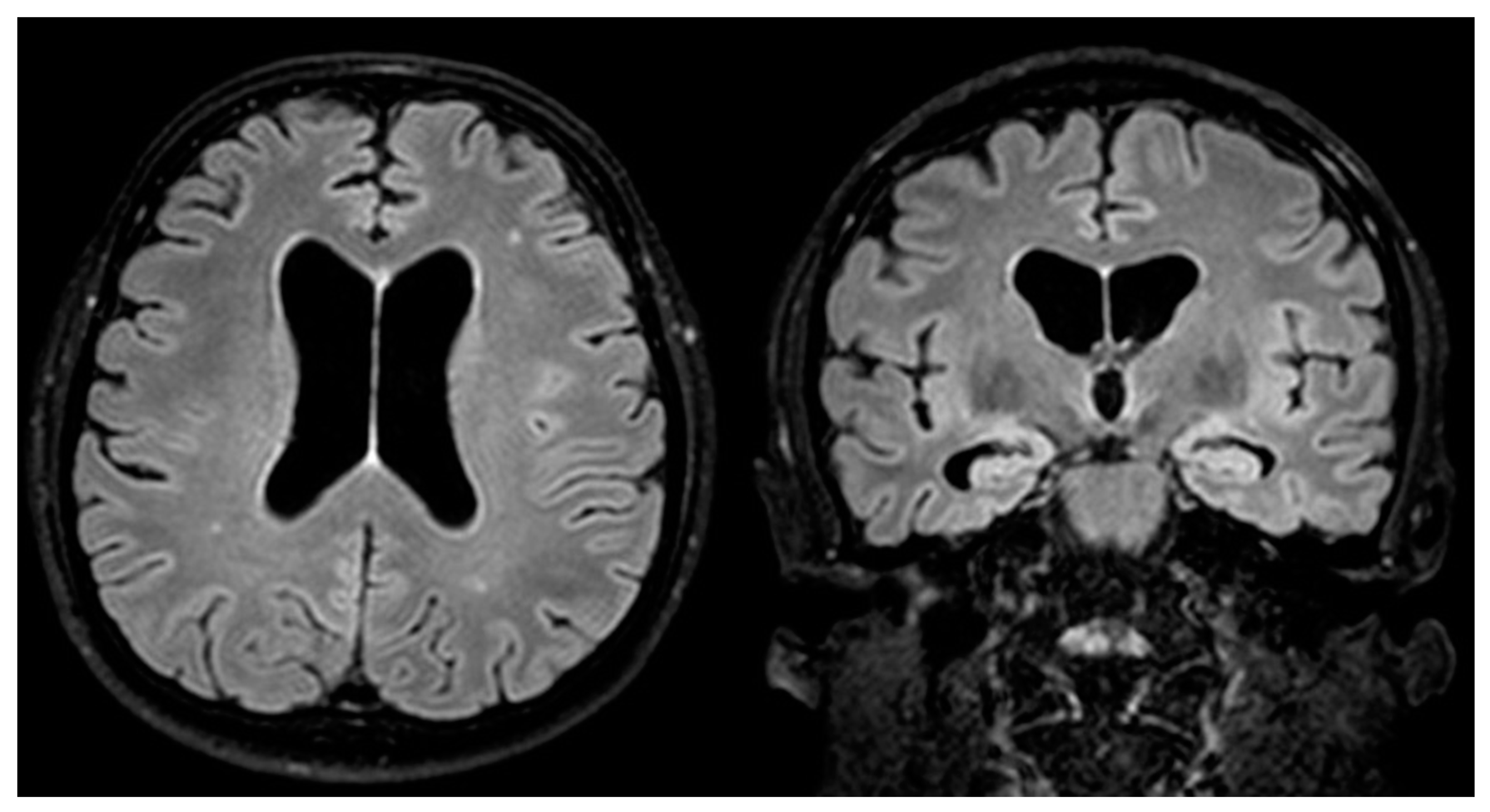 Neurosci 02 00031 g002