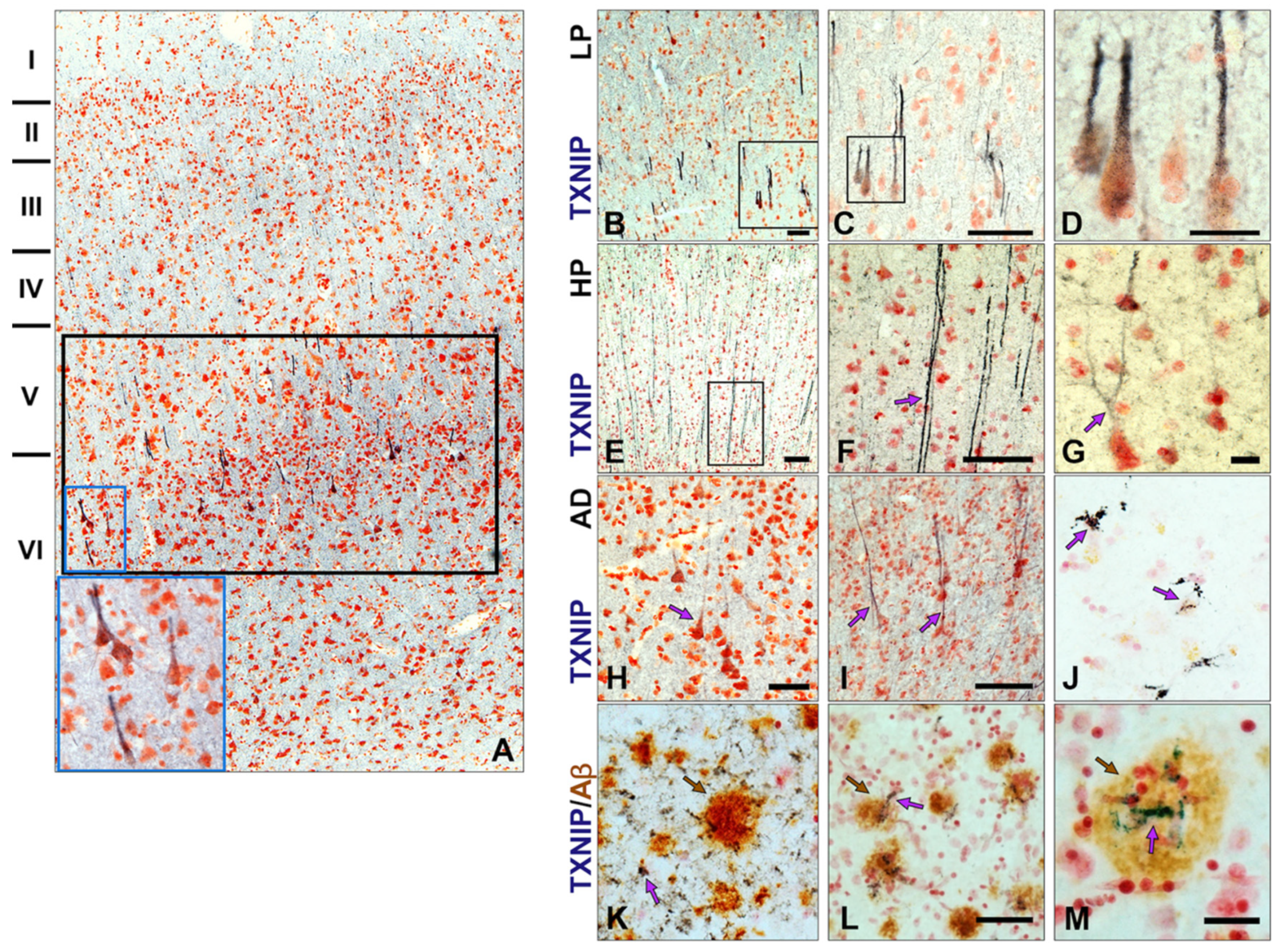 Neurosci 03 00013 g004
