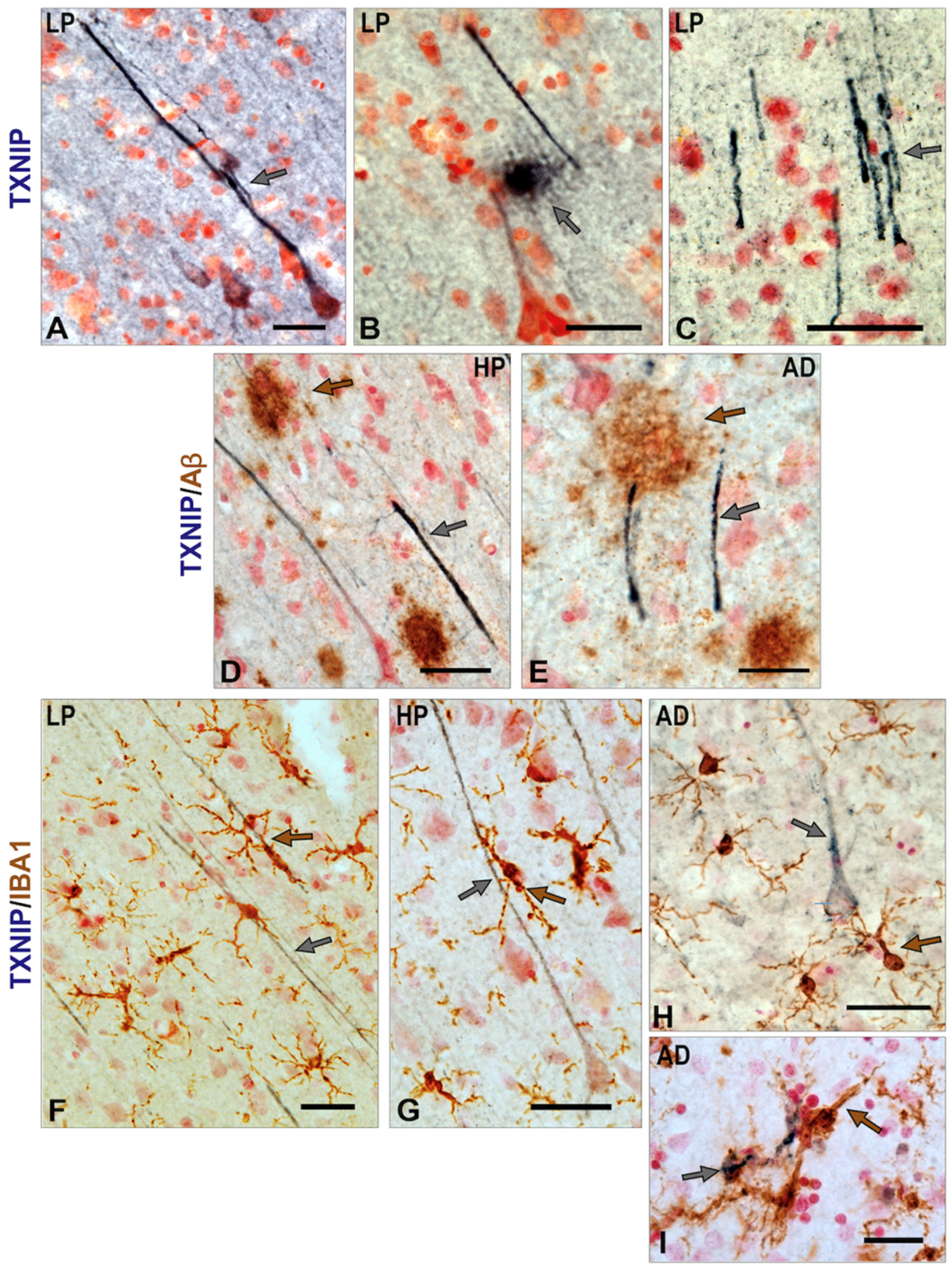 Neurosci 03 00013 g005