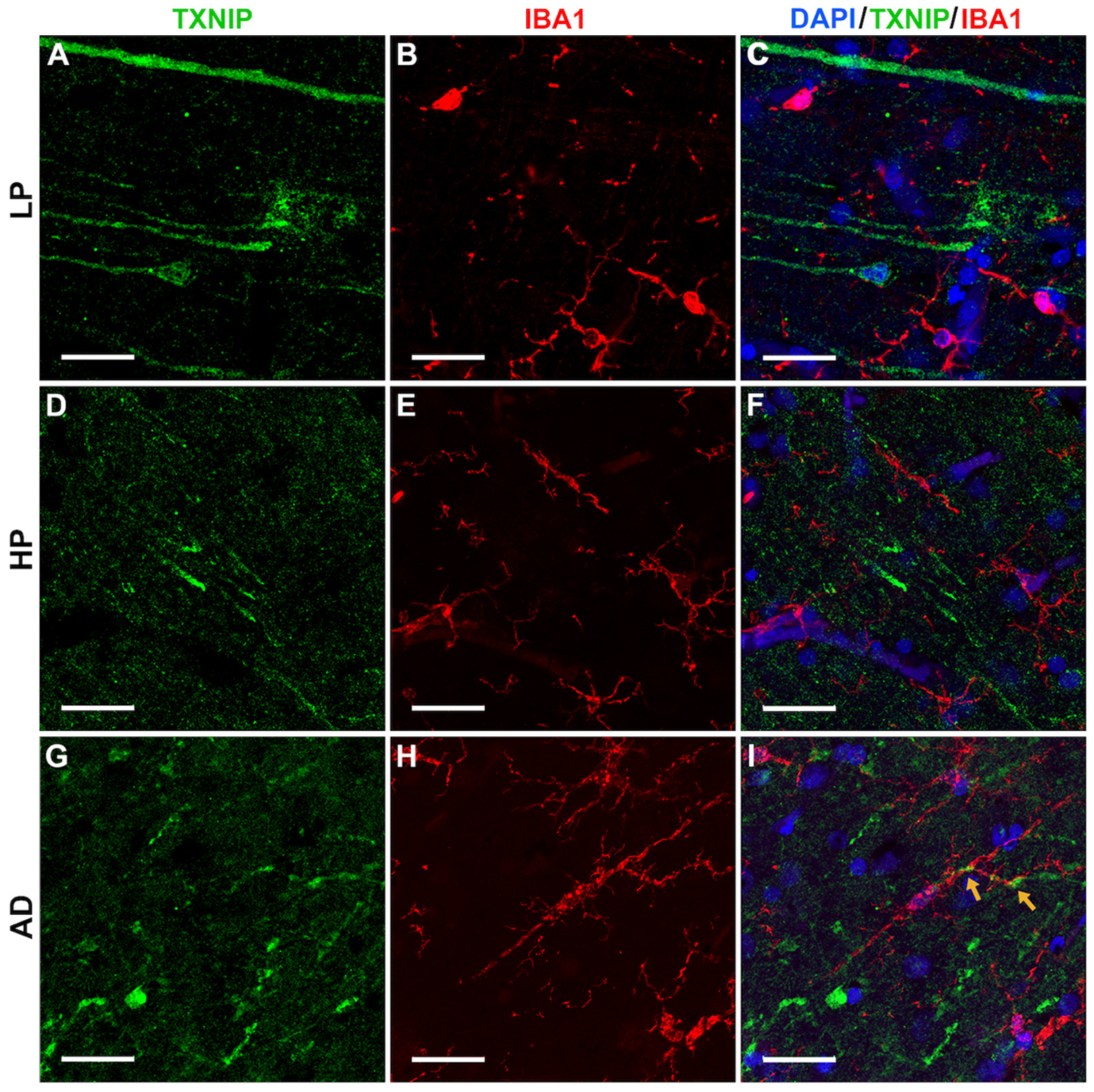 Neurosci 03 00013 g007