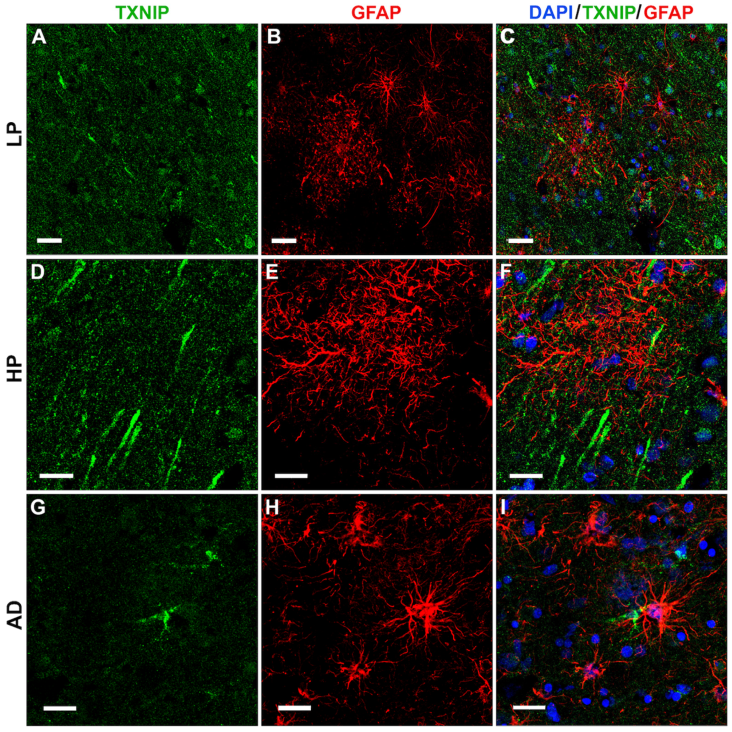 Neurosci 03 00013 g008