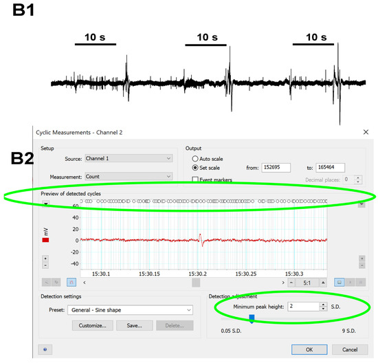 Neurosci 03 00041 g0a3b