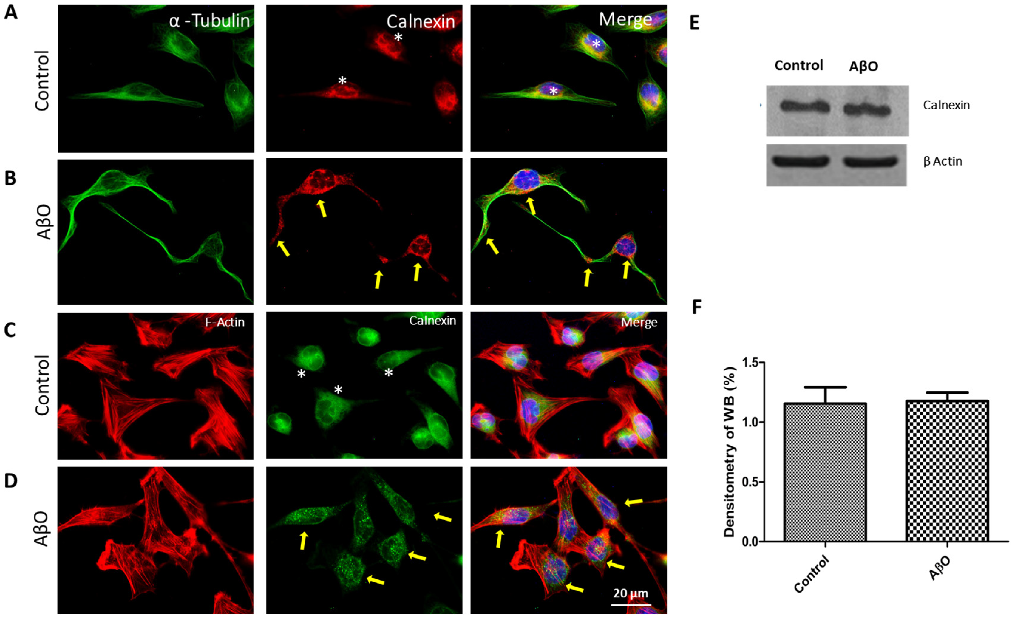 Neurosci 05 00010 g004