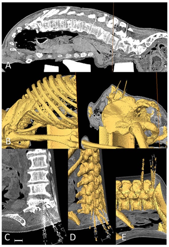 Neurosci 05 00044 g003