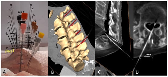 Neurosci 05 00044 g004