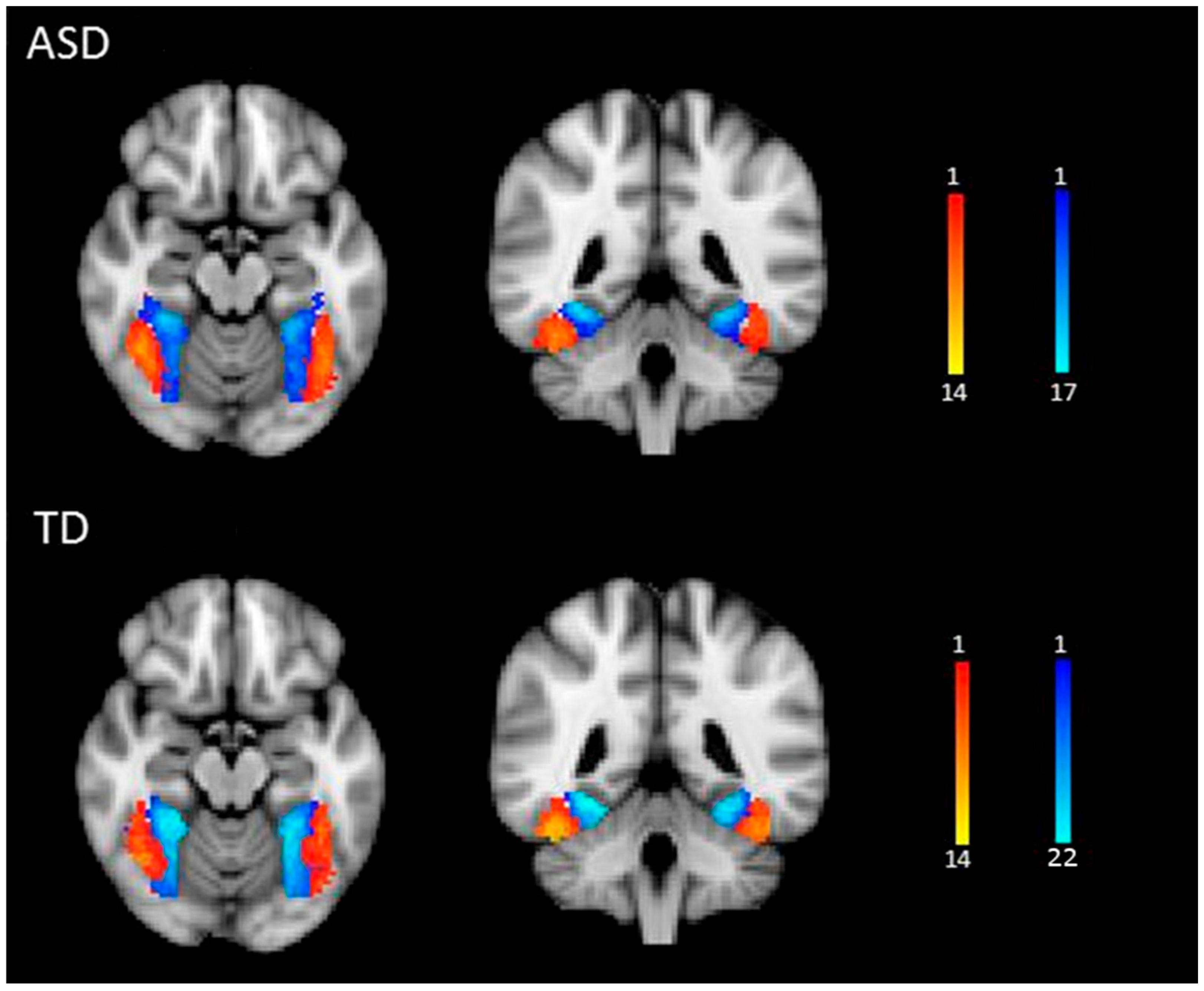 Neurosci 06 00029 g002 Neurosci 06 00029 g002