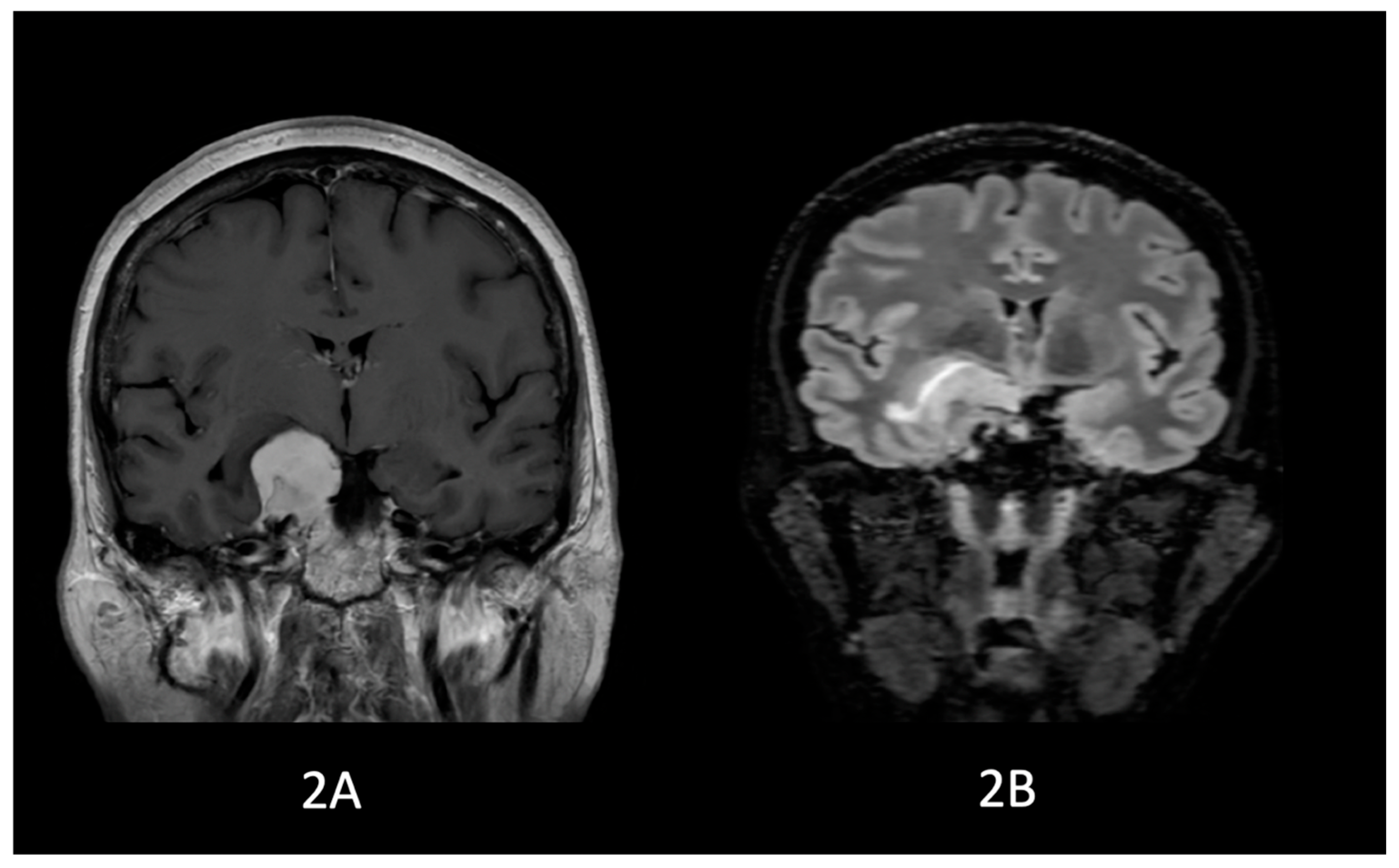 Neurosci 07 00004 g001b Neurosci 07 00004 g001b