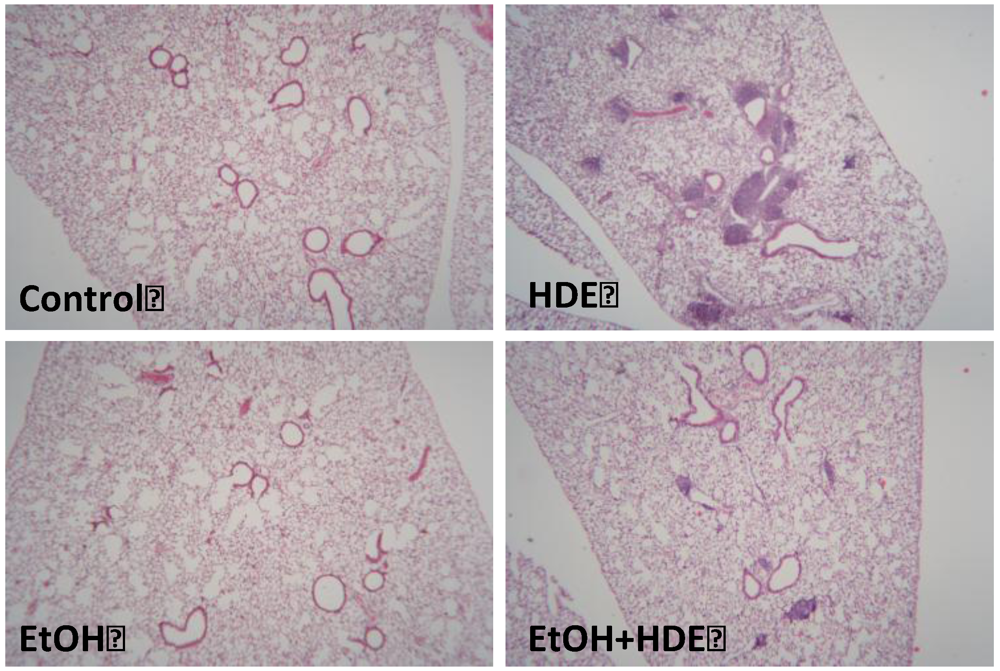 Nutrients 04 00695 g007 1024