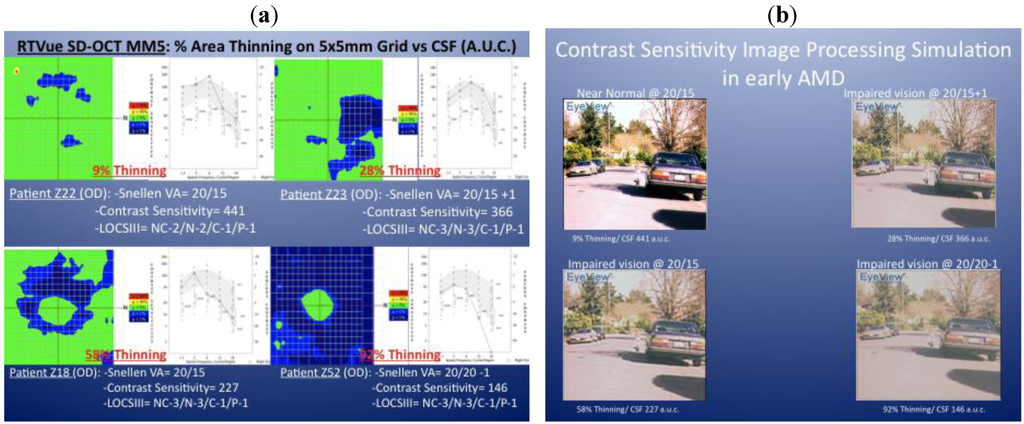 Nutrients 04 01812 g001 1024