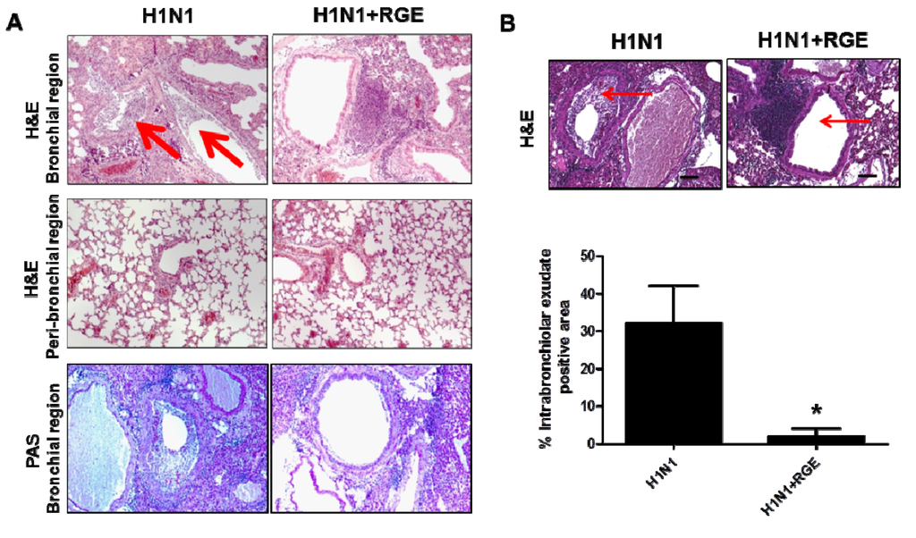 Nutrients 06 00517 g006 1024
