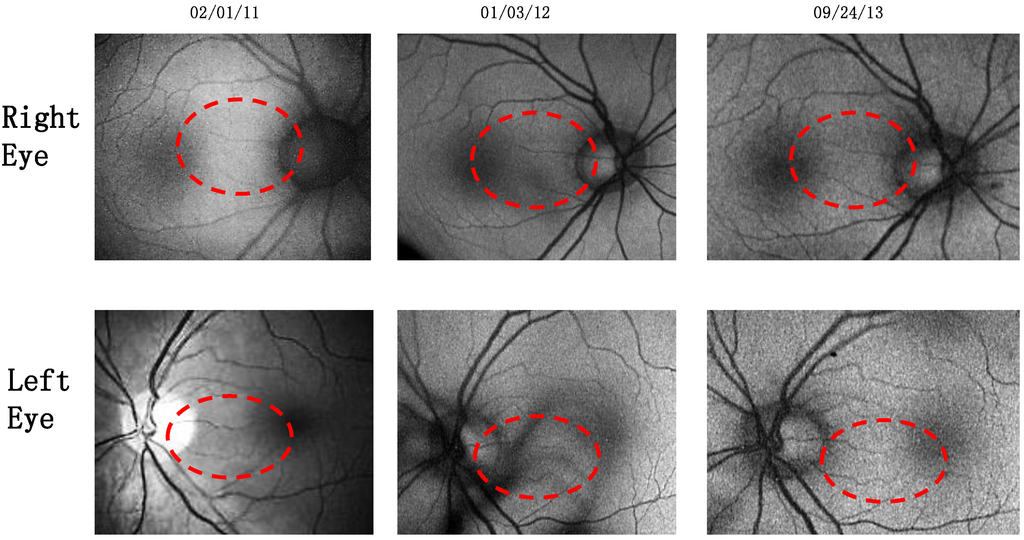 Nutrients 06 04404 g001 1024