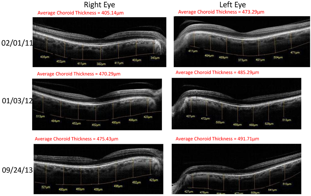 Nutrients 06 04404 g002 1024