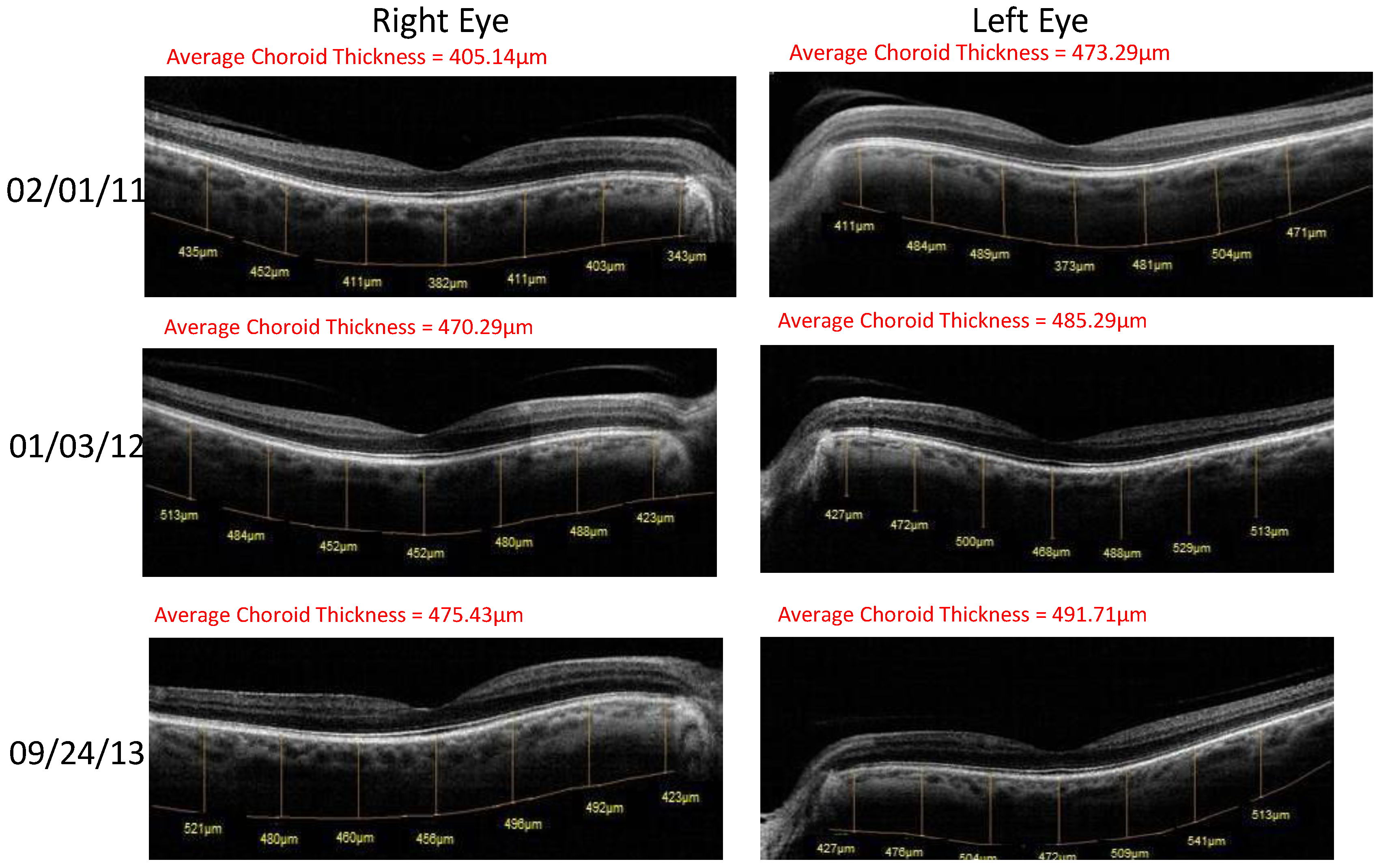 Nutrients 06 04404 g002