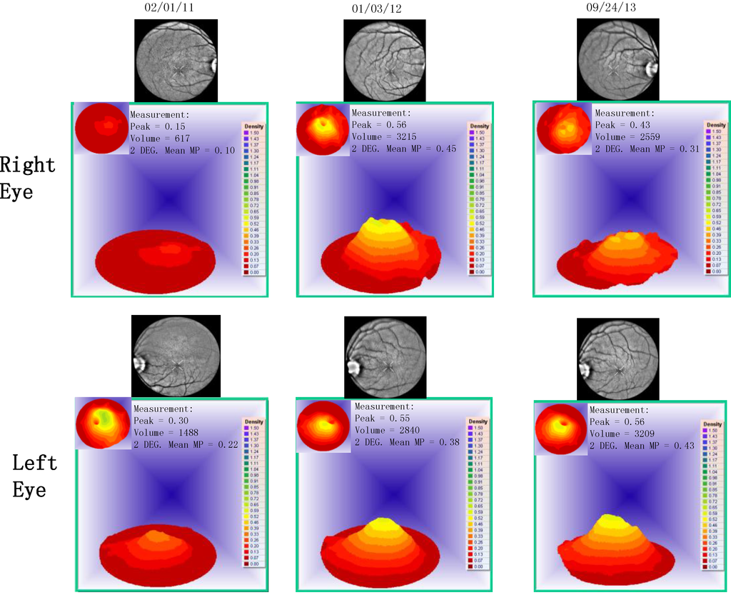 Nutrients 06 04404 g003 1024